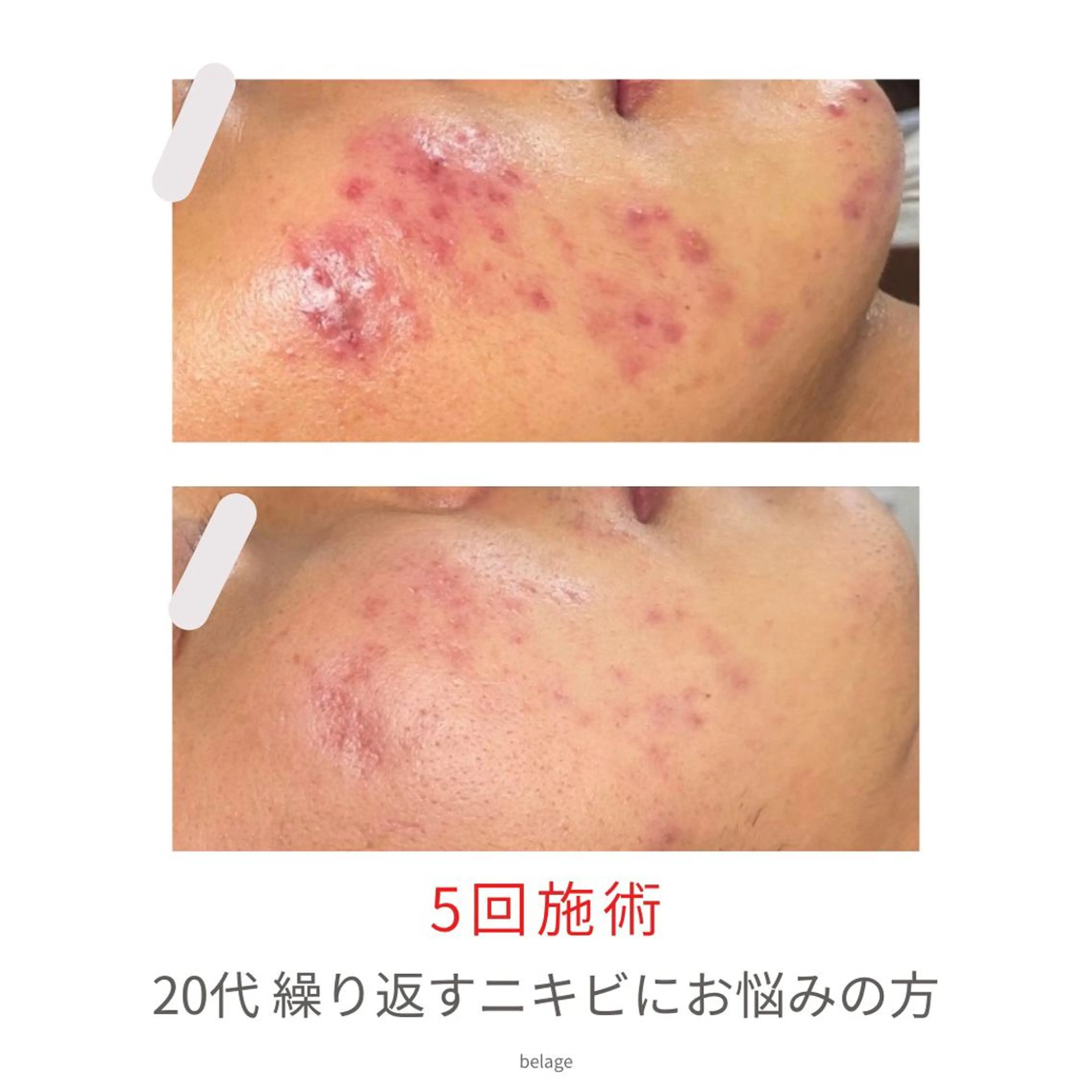 ベラージュ【美背中・ 美尻・フェイシャル】のエステ・リラクイメージ