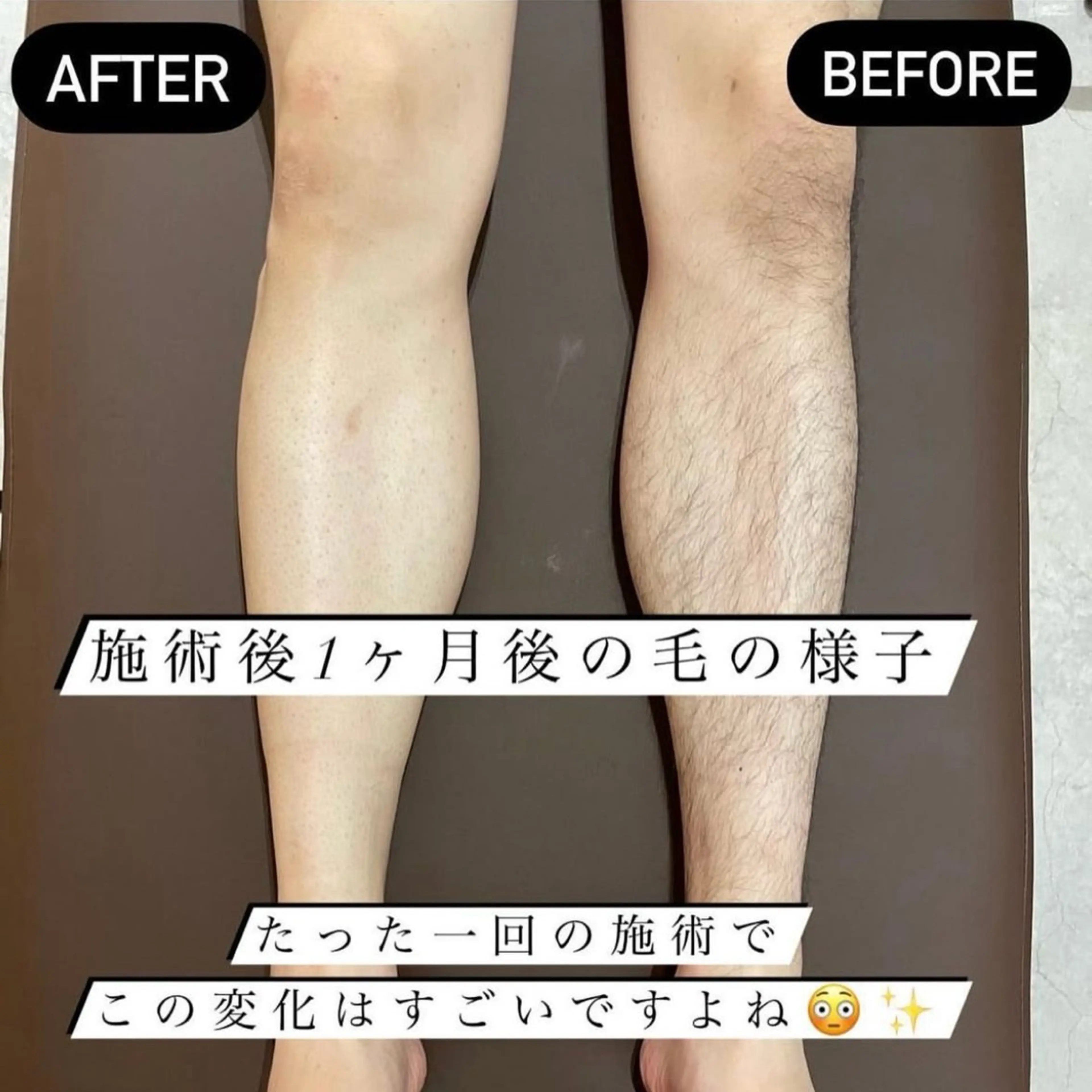 LARUTAN所属・エステ・脱毛 LARUTANのエステ・リラクイメージ