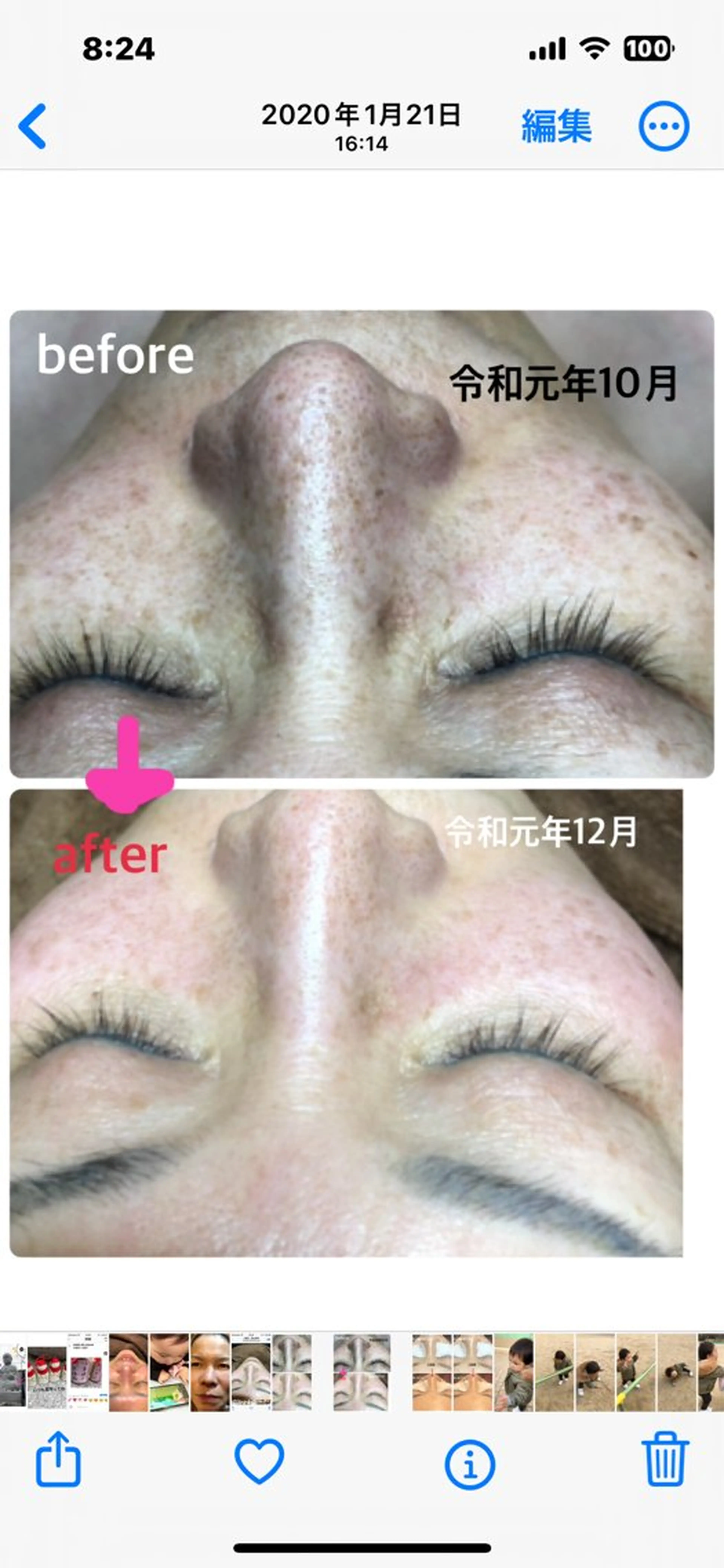 毛穴小顔・痩身サロン メイク・ド・ミュウのその他イメージ