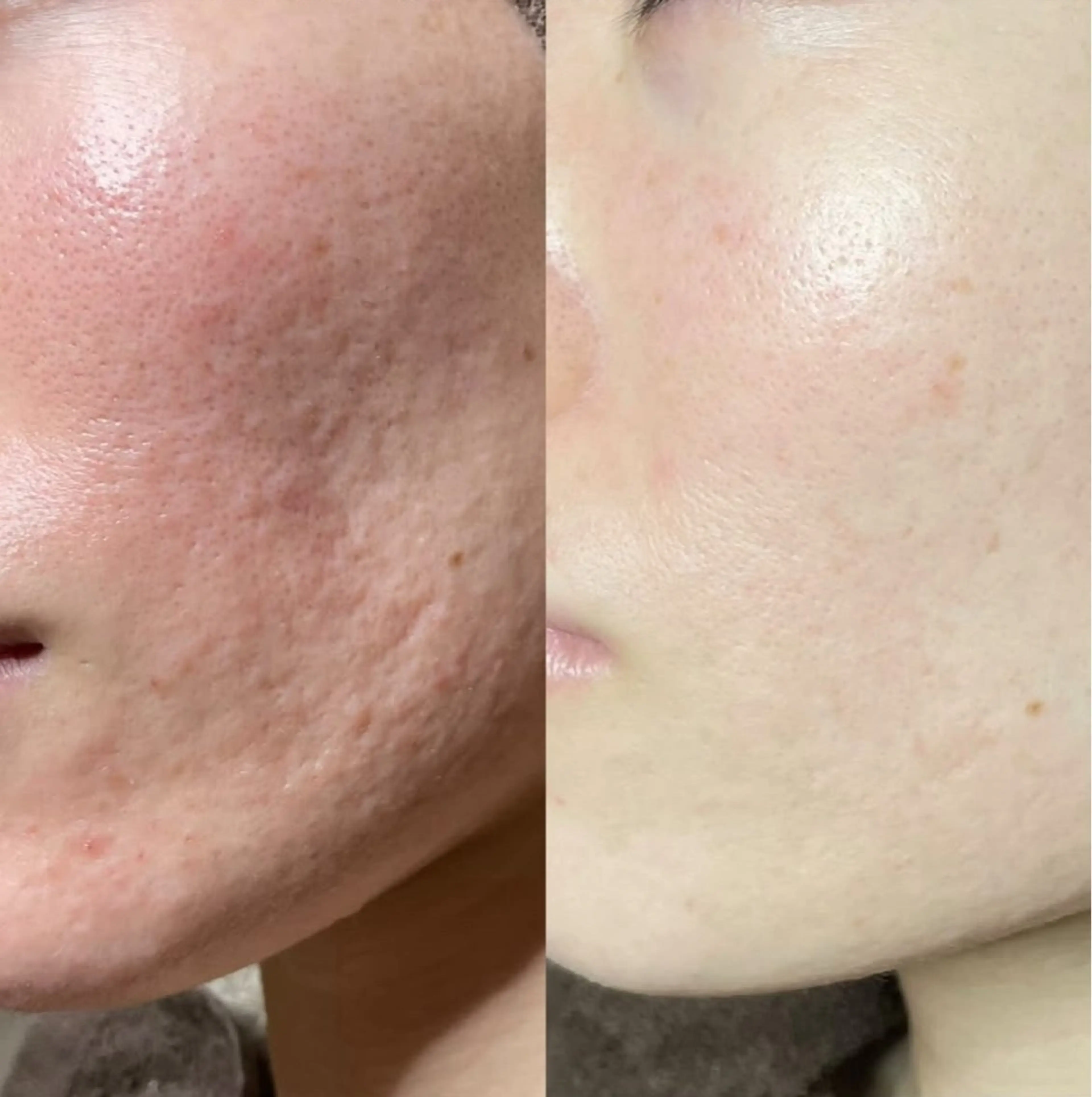 Blooming所属・LOUISE. ／肌質・頭皮のエステ・リラクイメージ