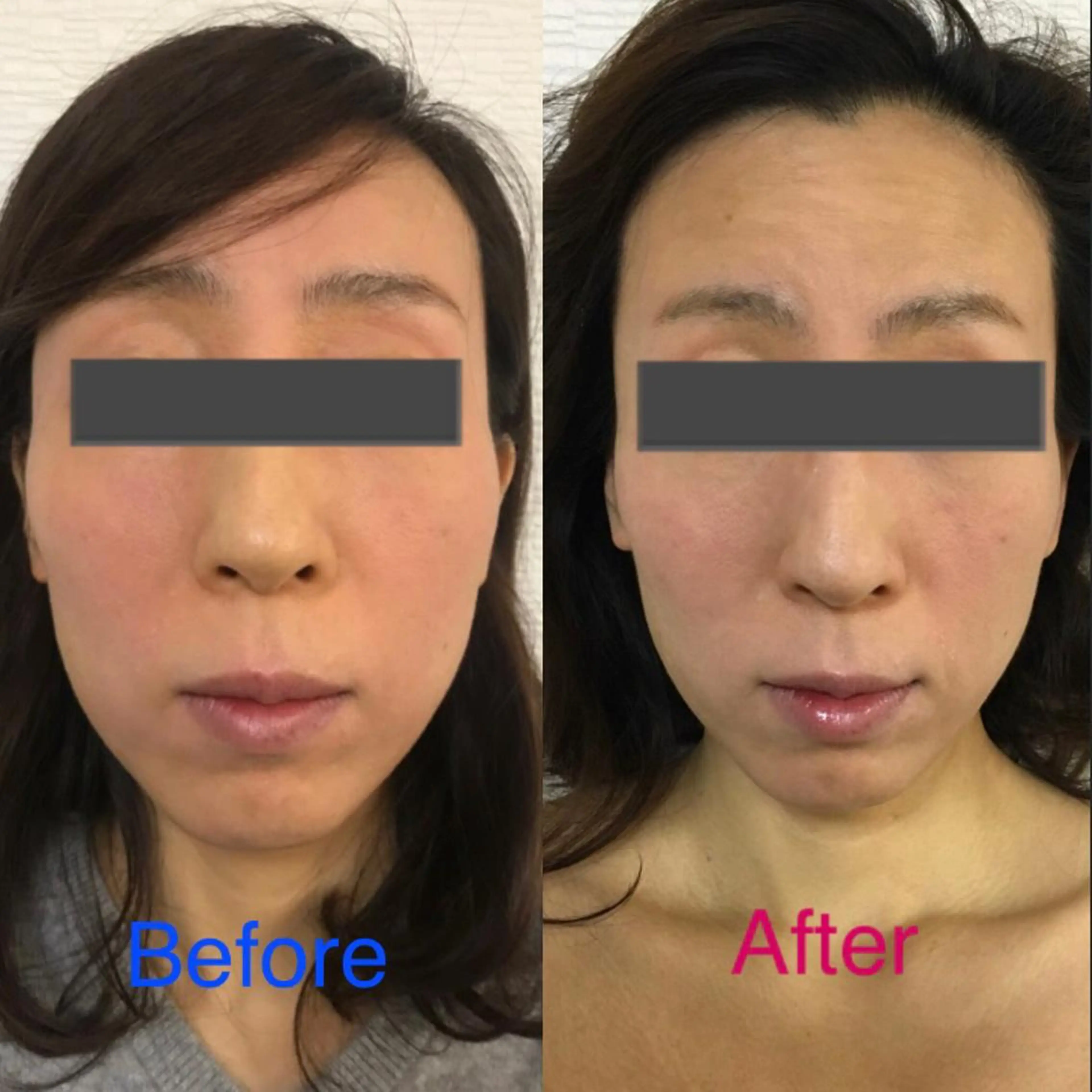 小顔筋膜矯正サロン桜Biscuit~サクラビスケット~所属・小顔/肩こり/脱毛 桜Bisucuitのエステ・リラクイメージ