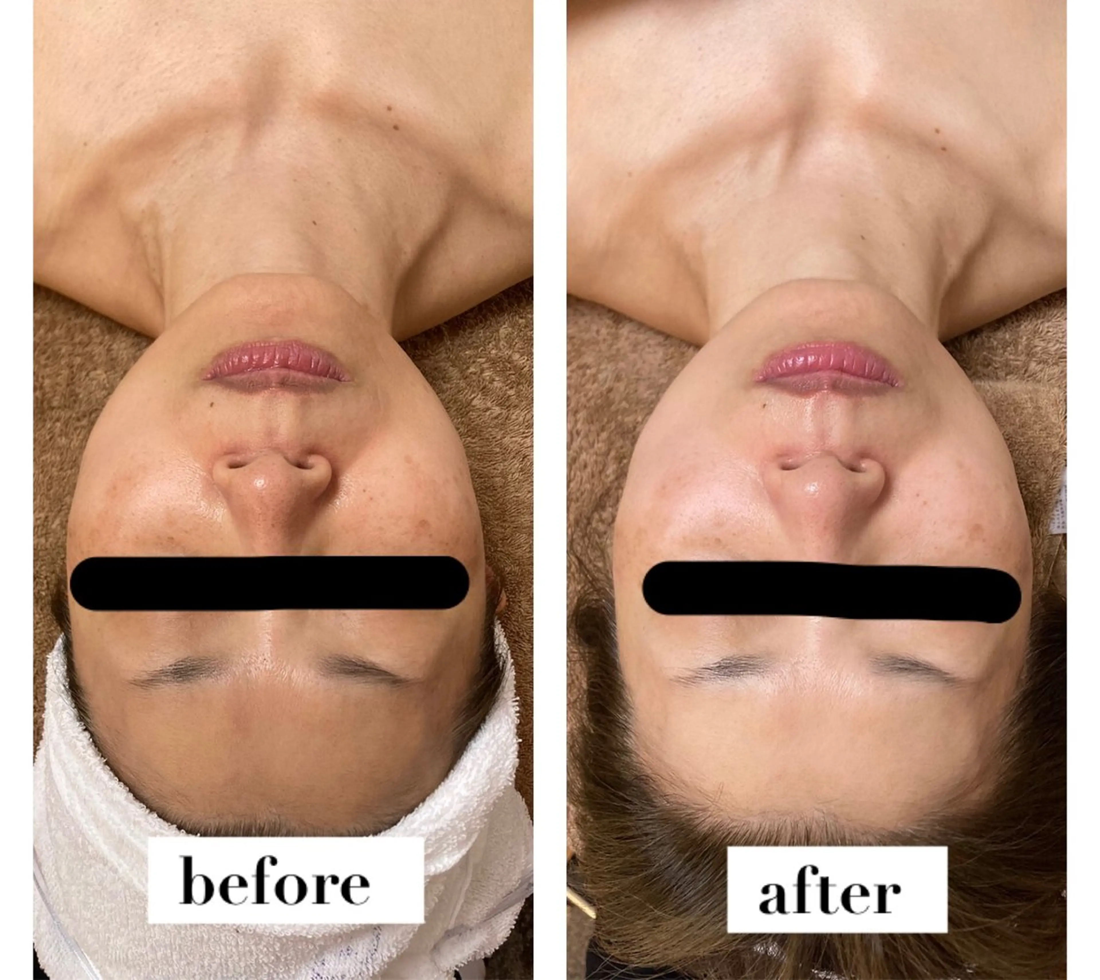 肌悩み改善 〜エステサロン〜のエステ・リラクイメージ