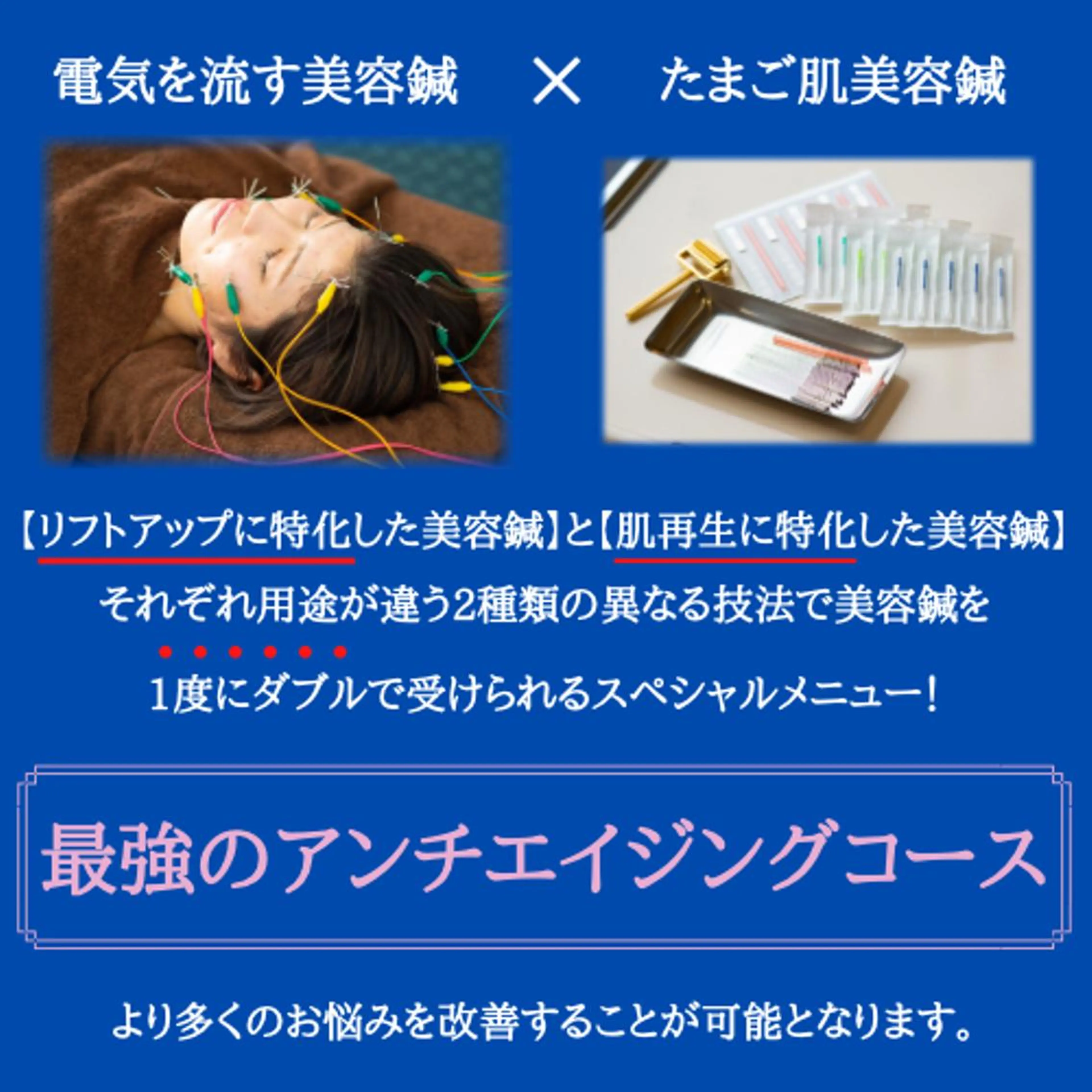 💐最強美肌コース💐（電気を流す美容鍼＋たまご肌美容鍼）の写真