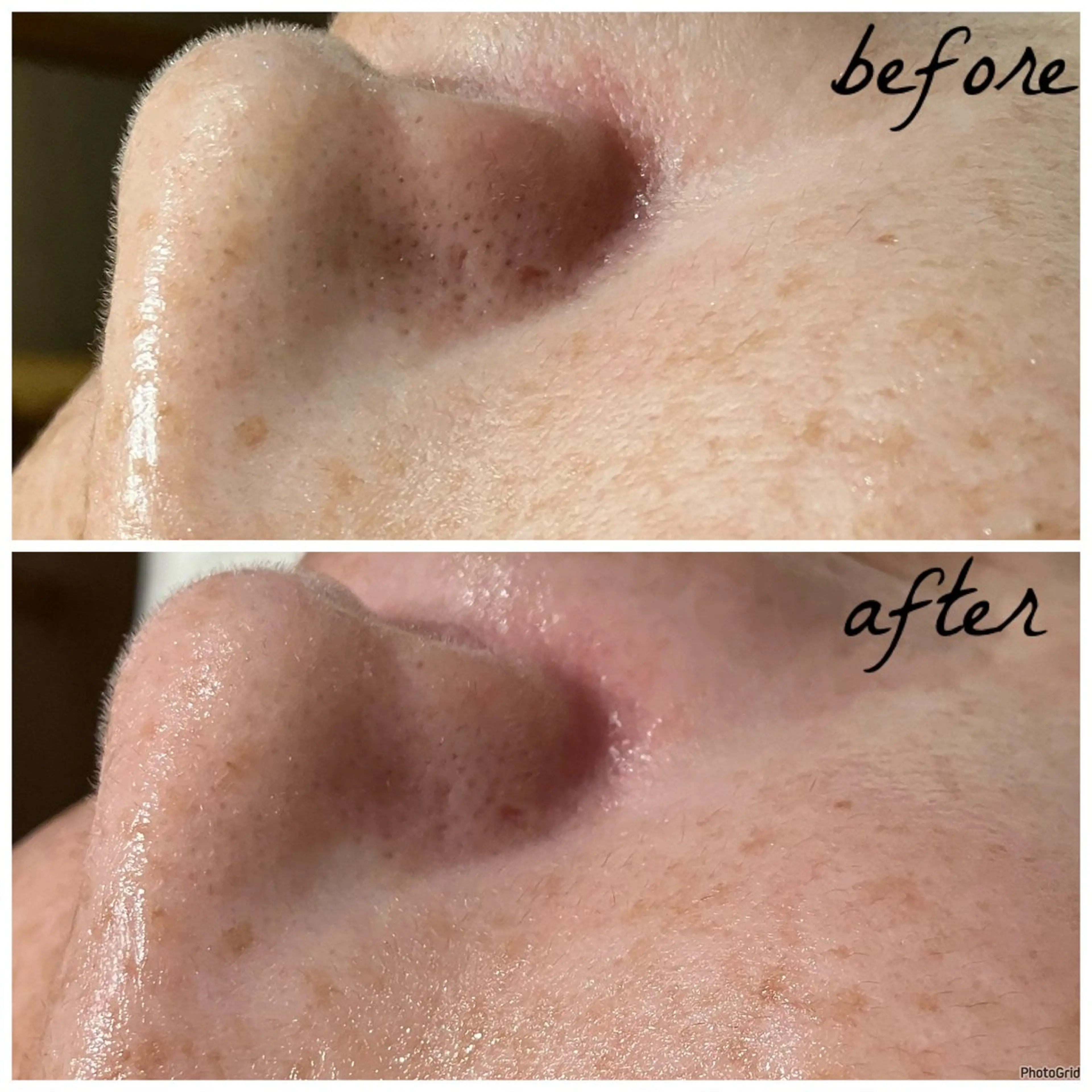 メンズ メナード岐阜茜部 杉浦のエステ・リラクイメージ