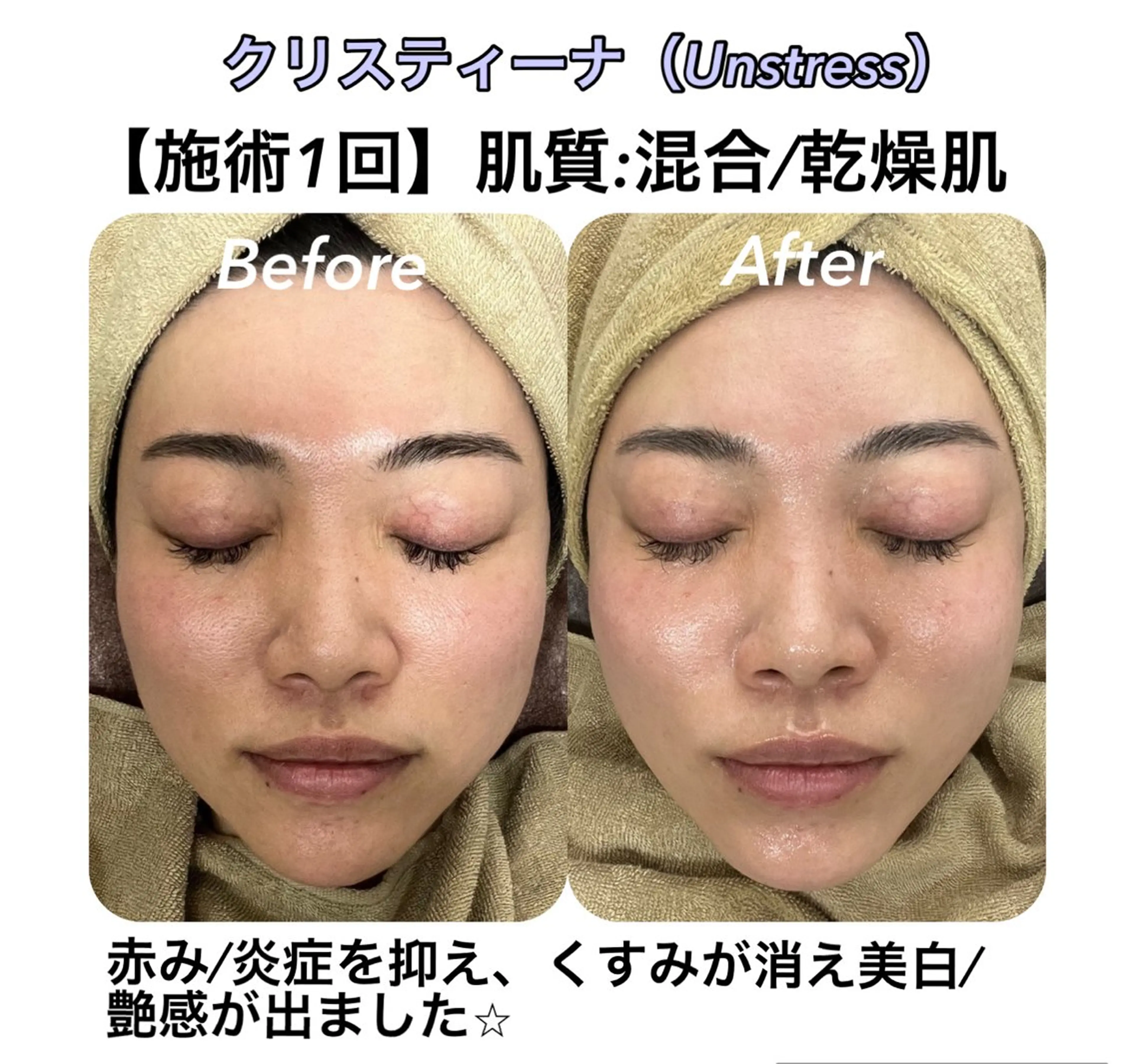 小顔&美肌品川店 Masqueradeのエステ・リラクイメージ