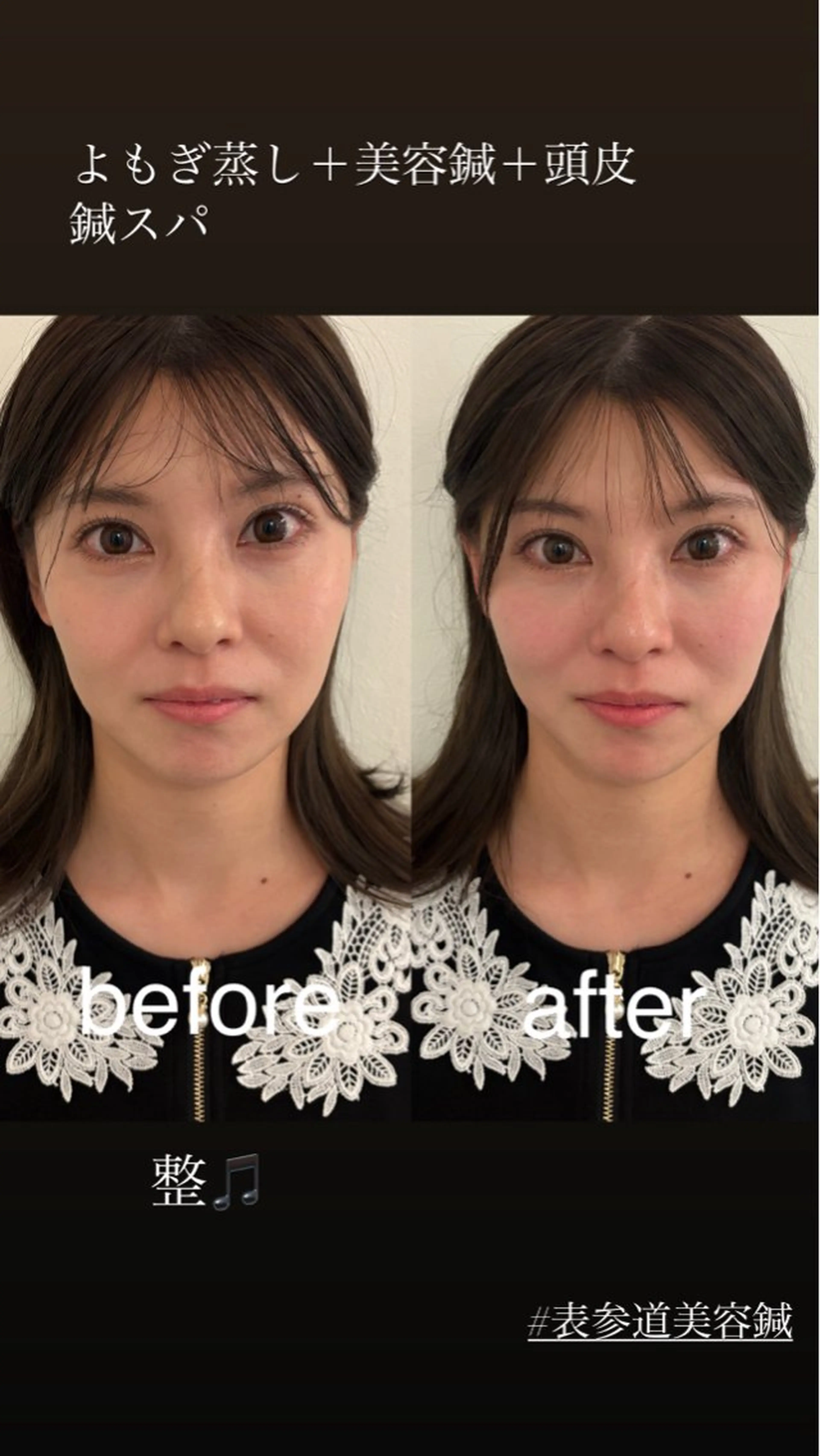 エステ リラク 美容鍼灸サロン mahoroba院長のエステ・リラクイメージ