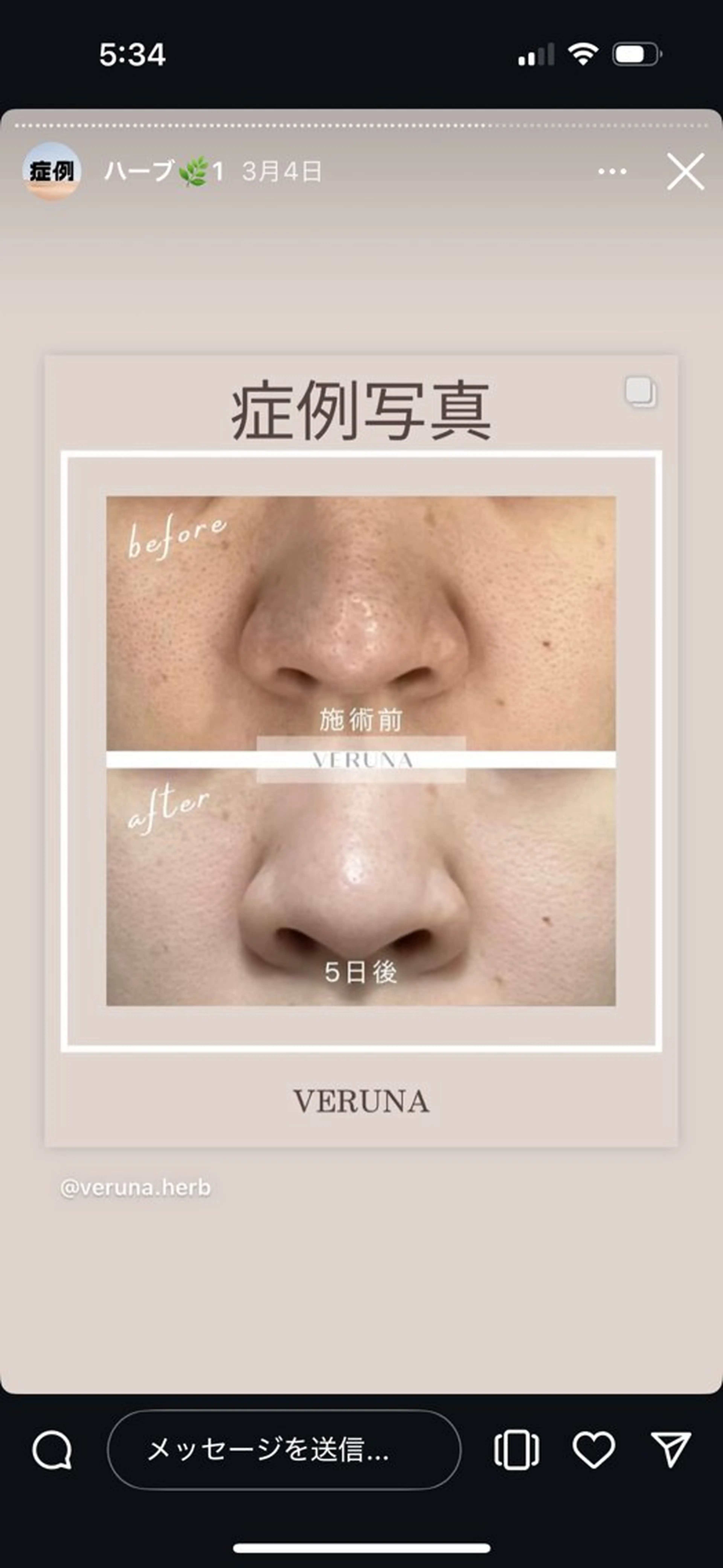 Grandir所属・ハーブピーリング専門 グランディール　武内のエステ・リラクイメージ