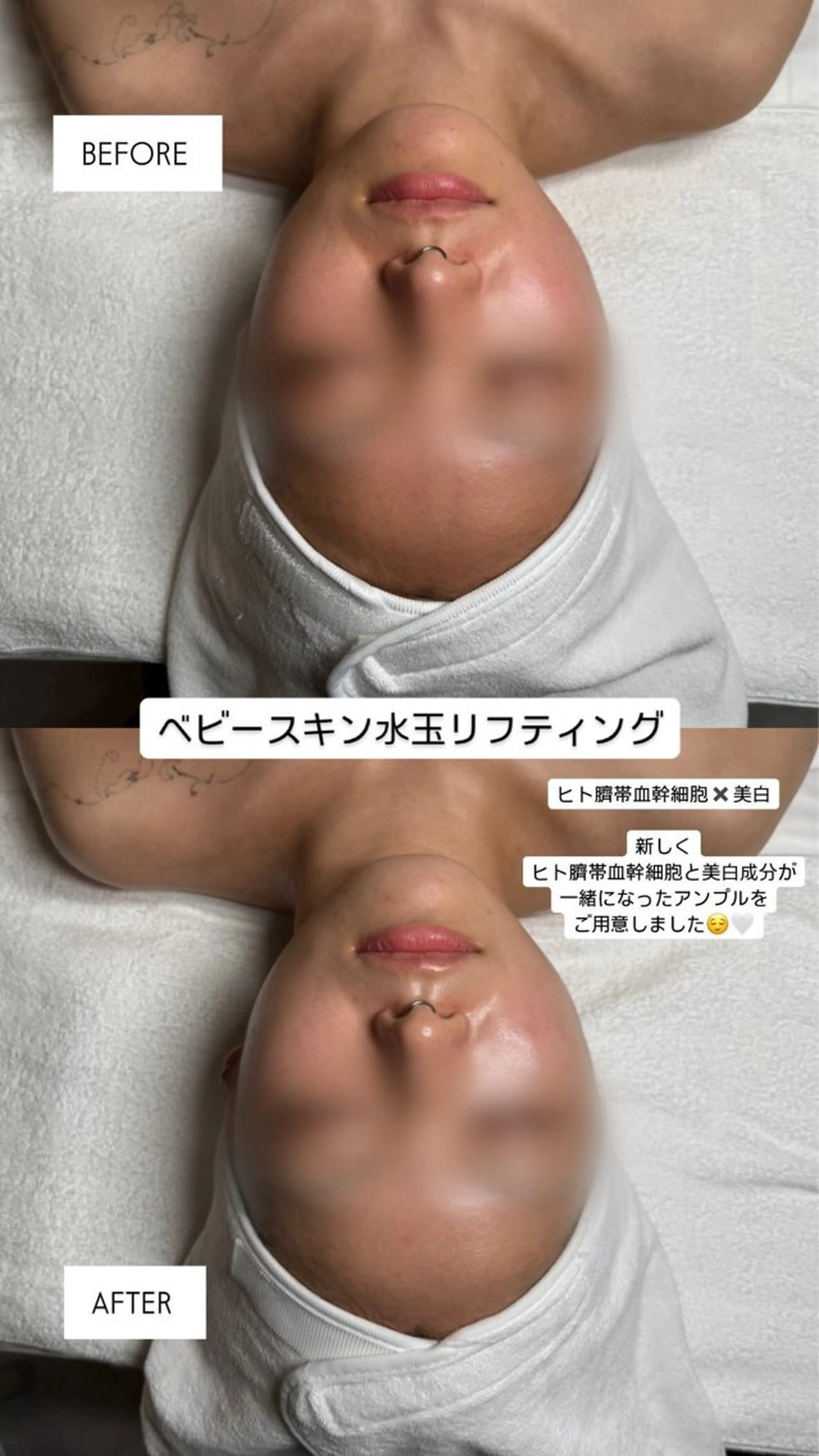 韓国肌管理🫧LDM 🫧Junnaのエステ・リラクイメージ