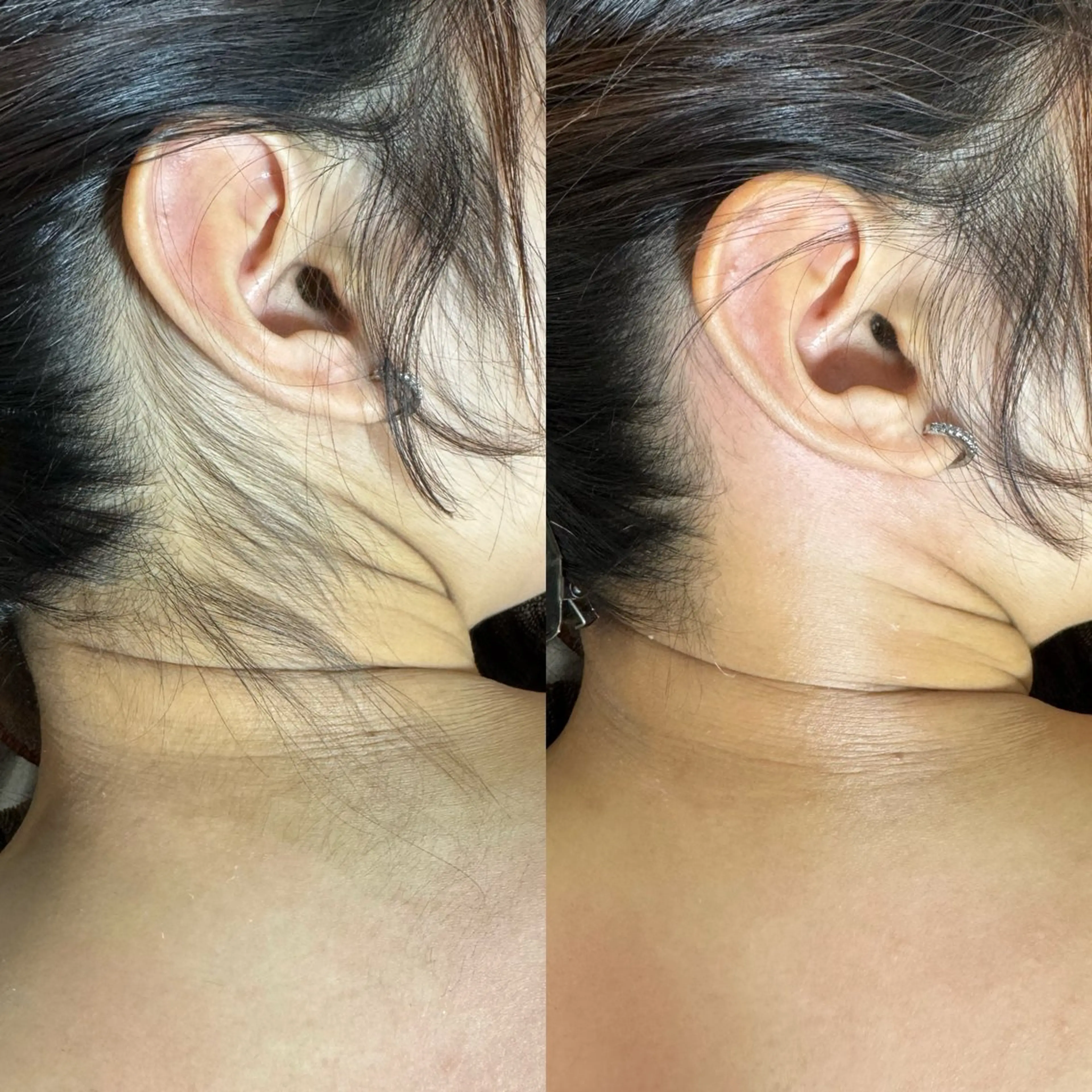 脱毛 六本木脱毛andS 店長Sachiのエステ・リラクイメージ