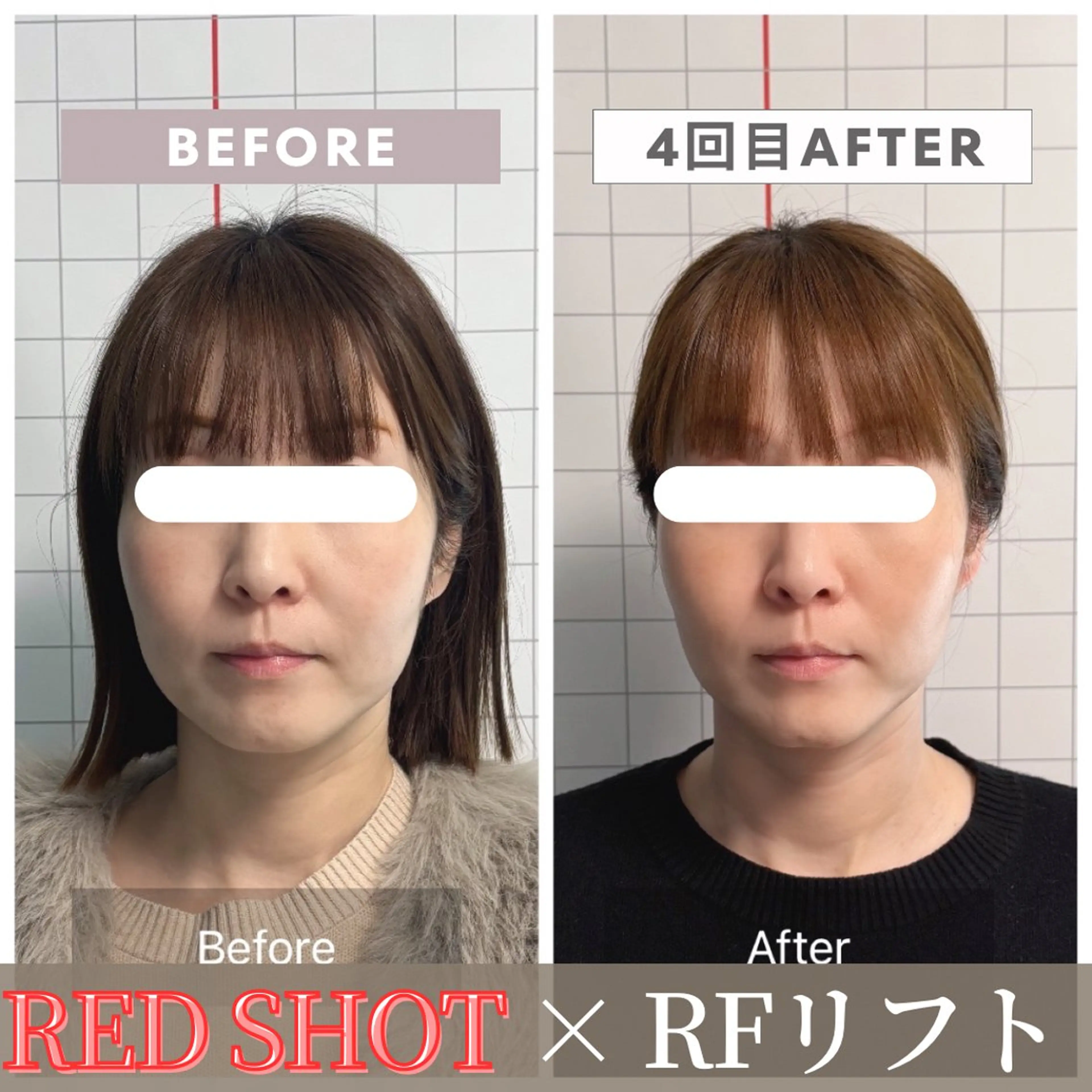 エステ リラク 小顔矯正専門店 【RED】池田のエステ・リラクイメージ