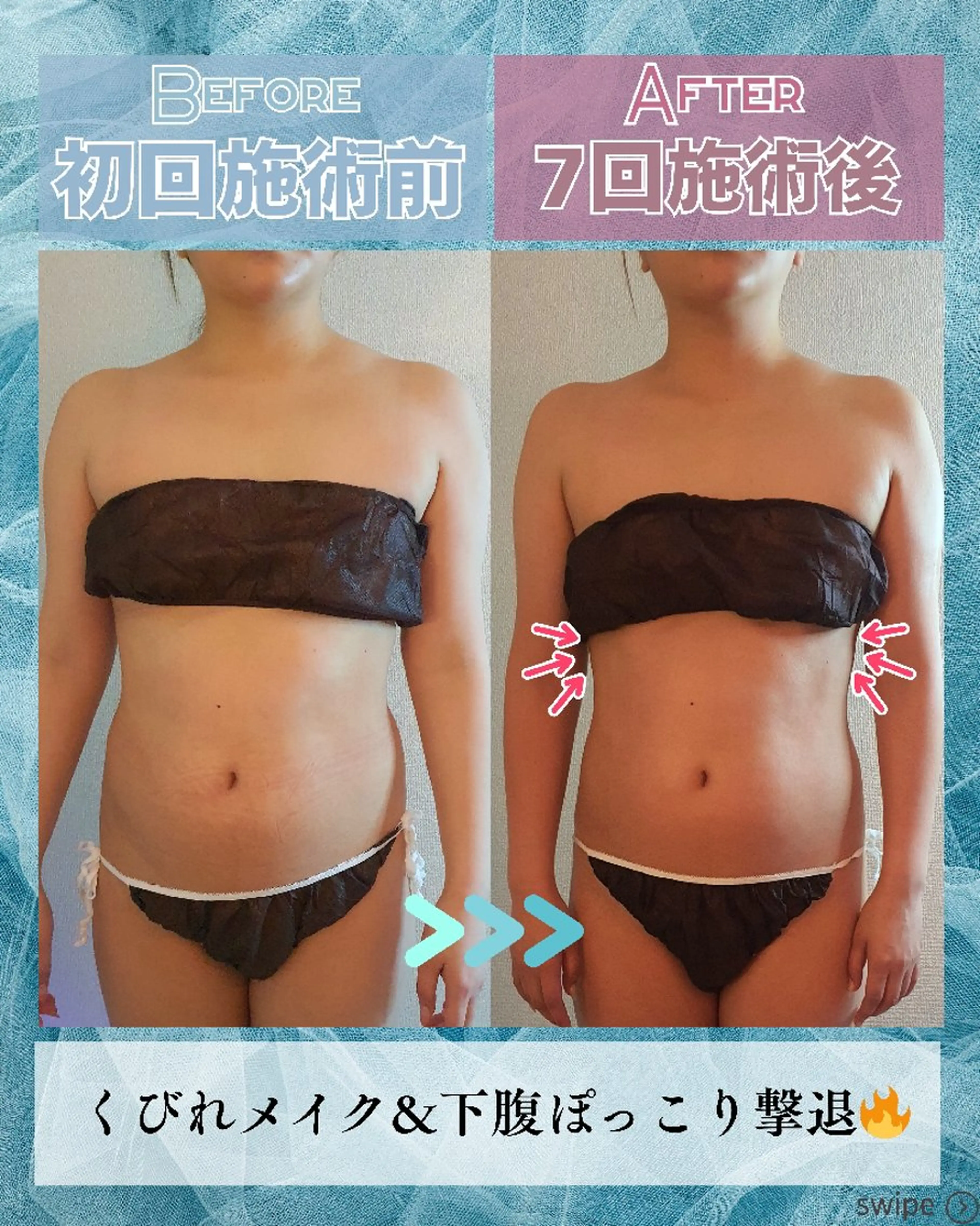 エステ リラク 痩身ハーブピーリング 筋膜リリース☆B&Hのエステ・リラクイメージ