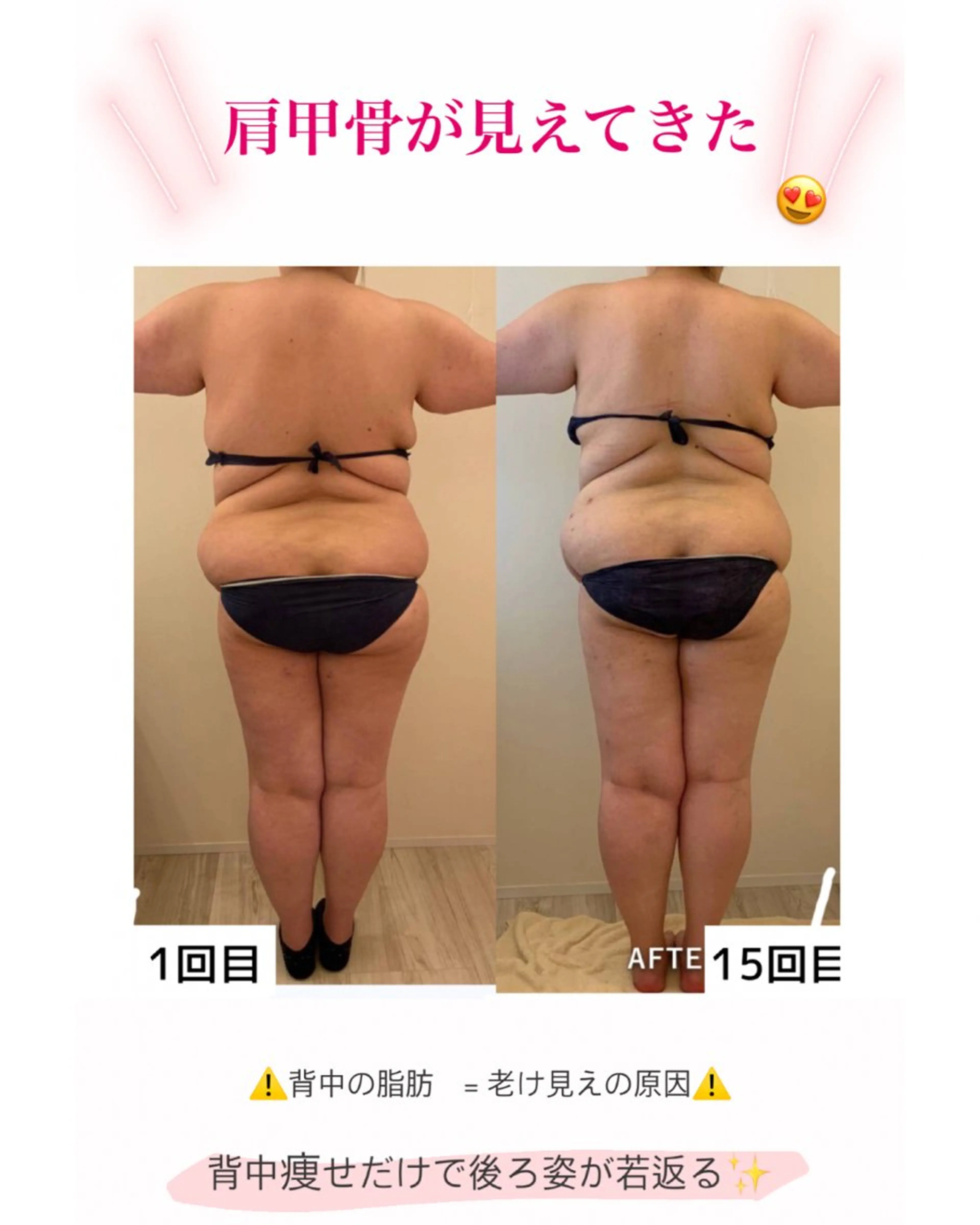 産後ダイエット−9㎏ Pourvous結衣のエステ・リラクイメージ