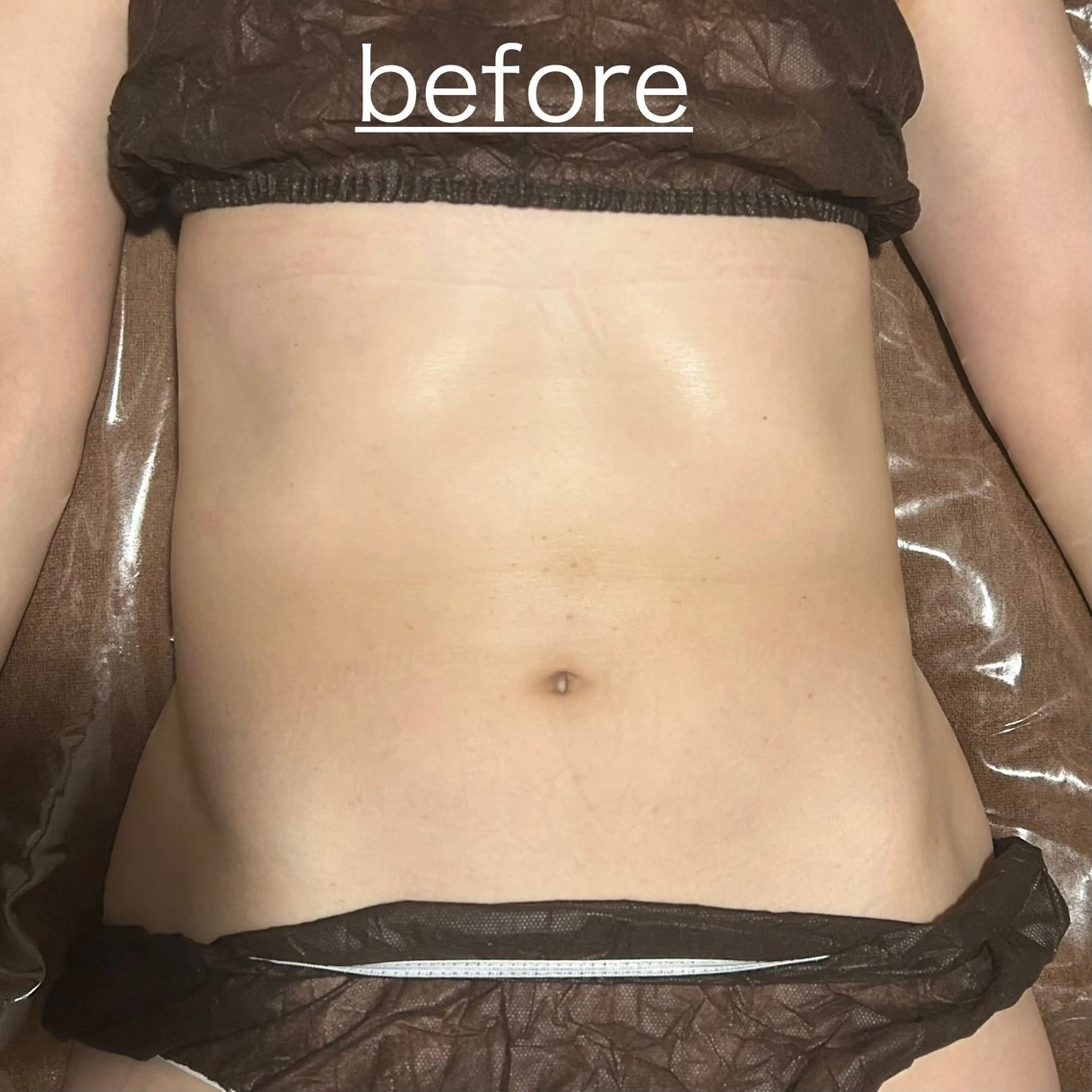 PIUMA 筋膜リリース・リンパのエステ・リラクイメージ