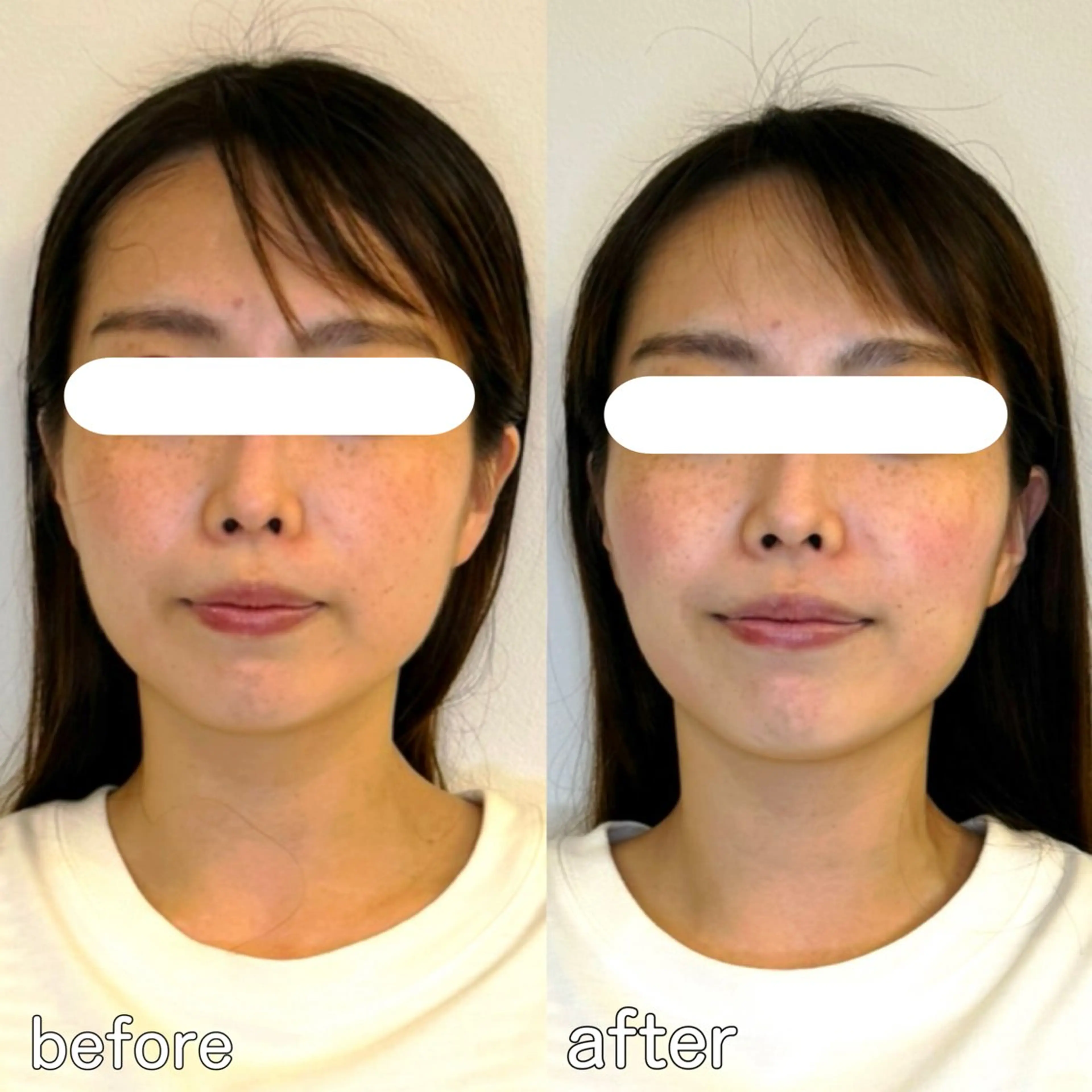 小顔矯正&美容整体 整え屋REDオーナーのエステ・リラクイメージ