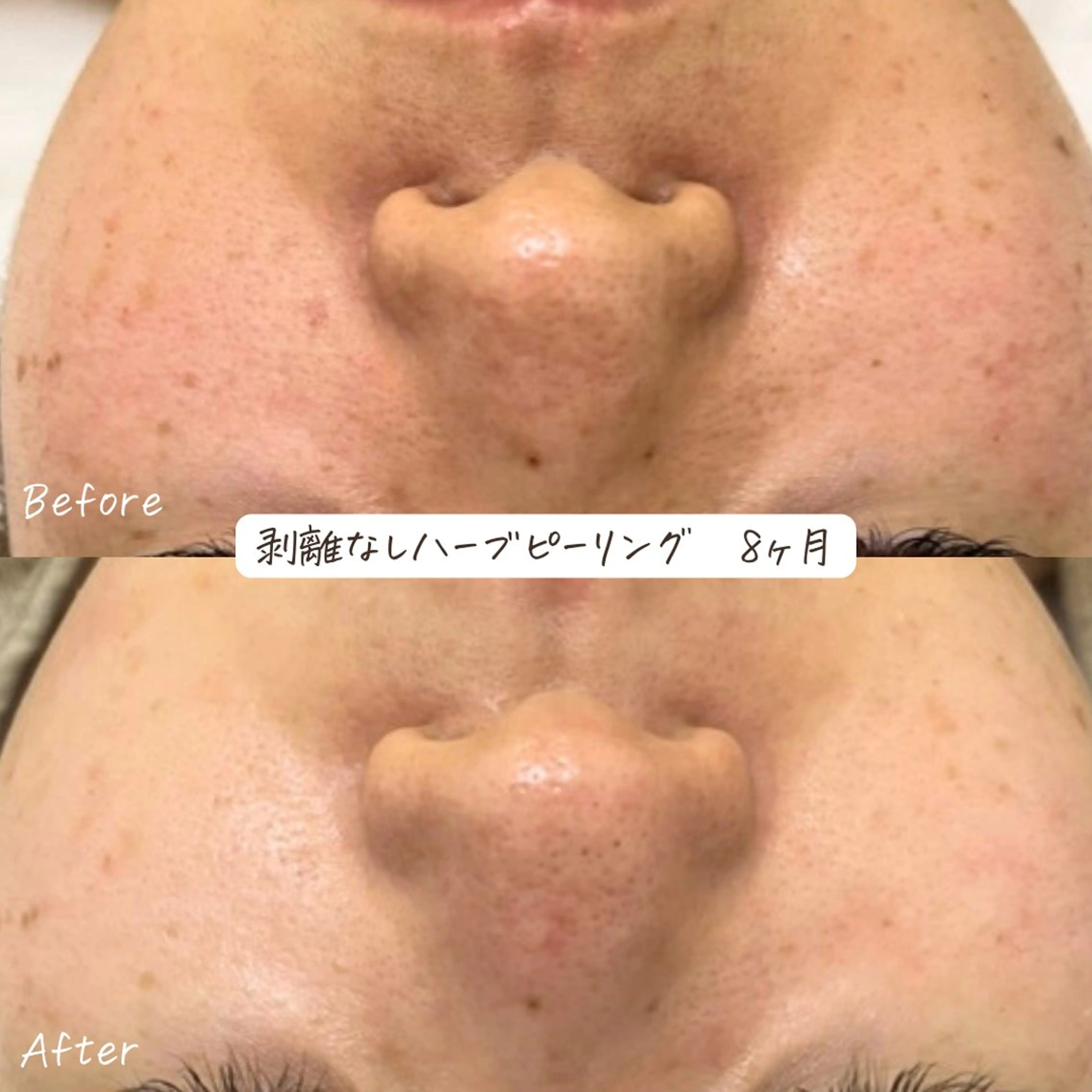 エステ 肌質改善サロン renew所属・肌質改善サロン renew/ｳｴｷのエステ・リラクイメージ