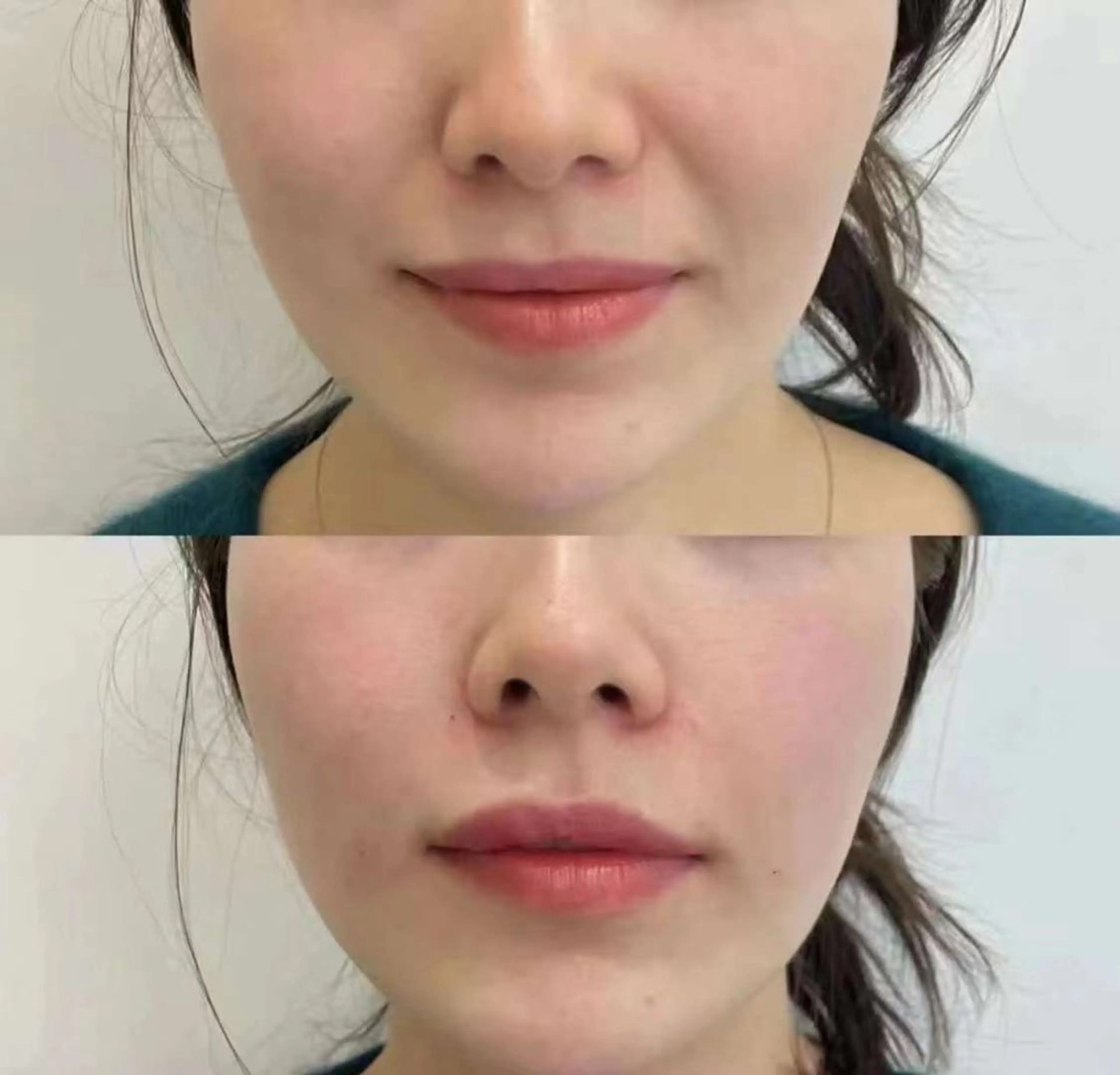 ショート カラー パーマ マツエク・マツパ 韓国風マツエク 韓国風ヘア 小顔カット エステ aliaハイフ&水光ジェットサロン所属・aliaハーブ水光店 エステティシャン募集のエステ・リラクイメージ