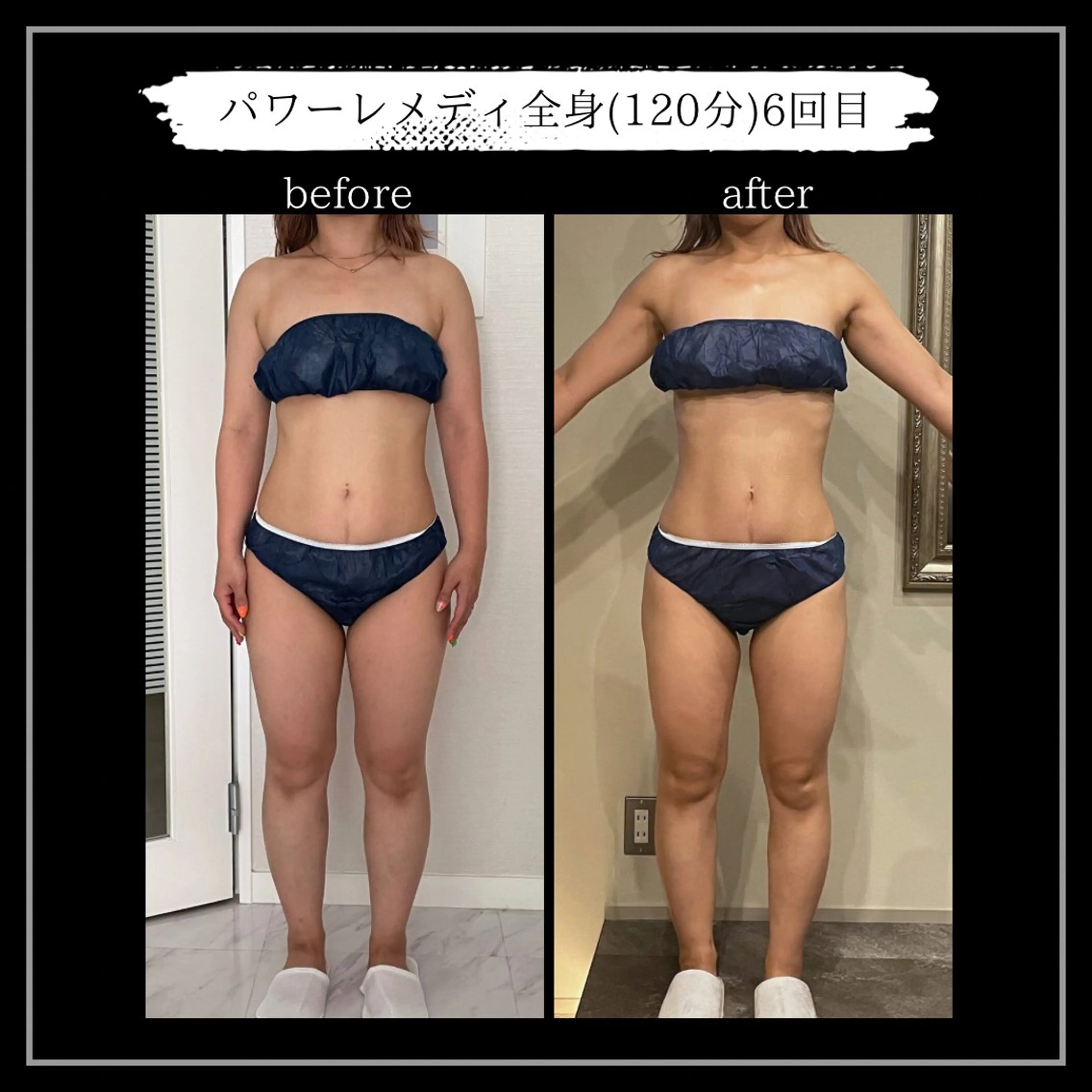 オフ:オン所属・オフ:オン 全身筋膜マッサージのエステ・リラクイメージ