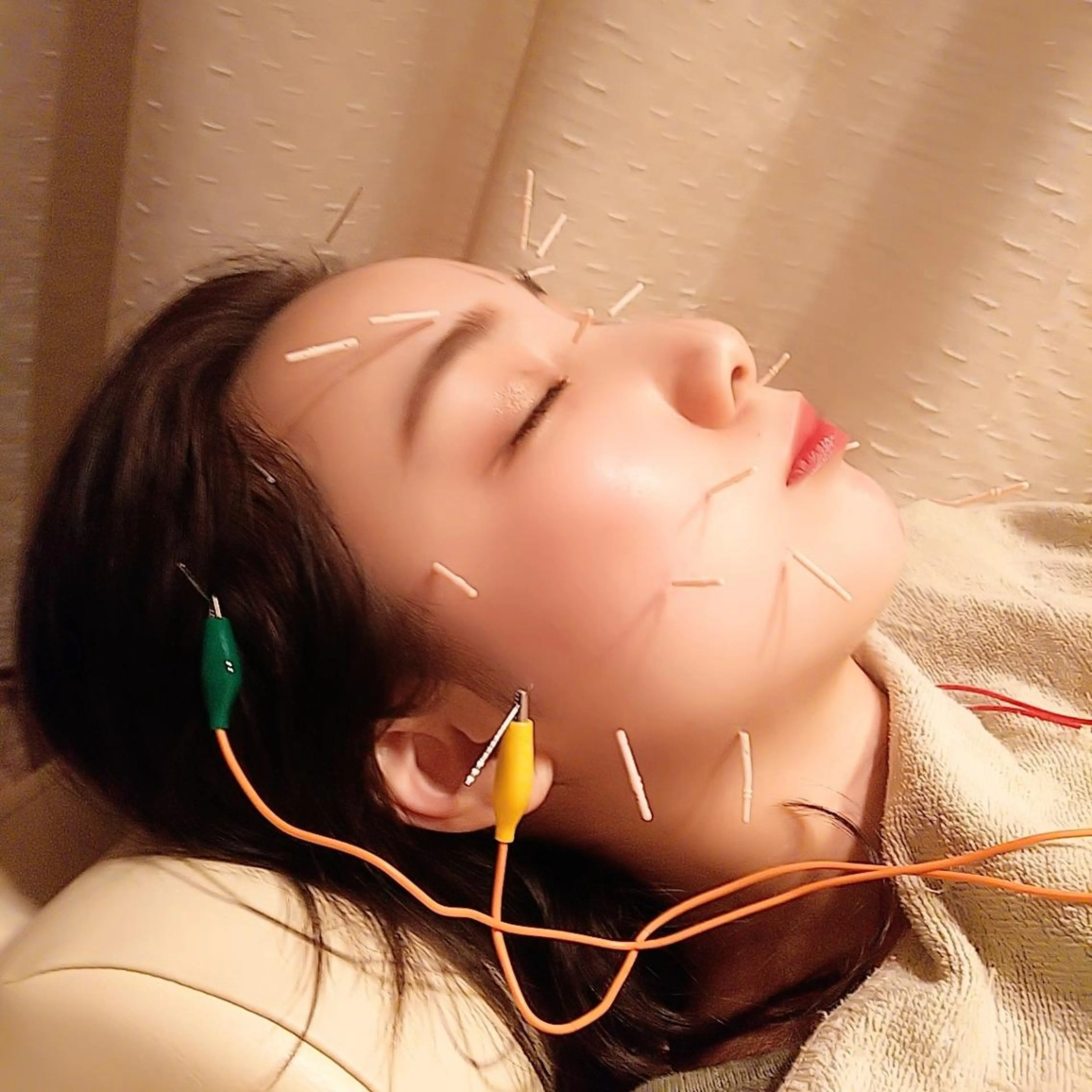 むくみたるみ専門☆ 美容鍼・小顔矯正のエステ・リラクイメージ