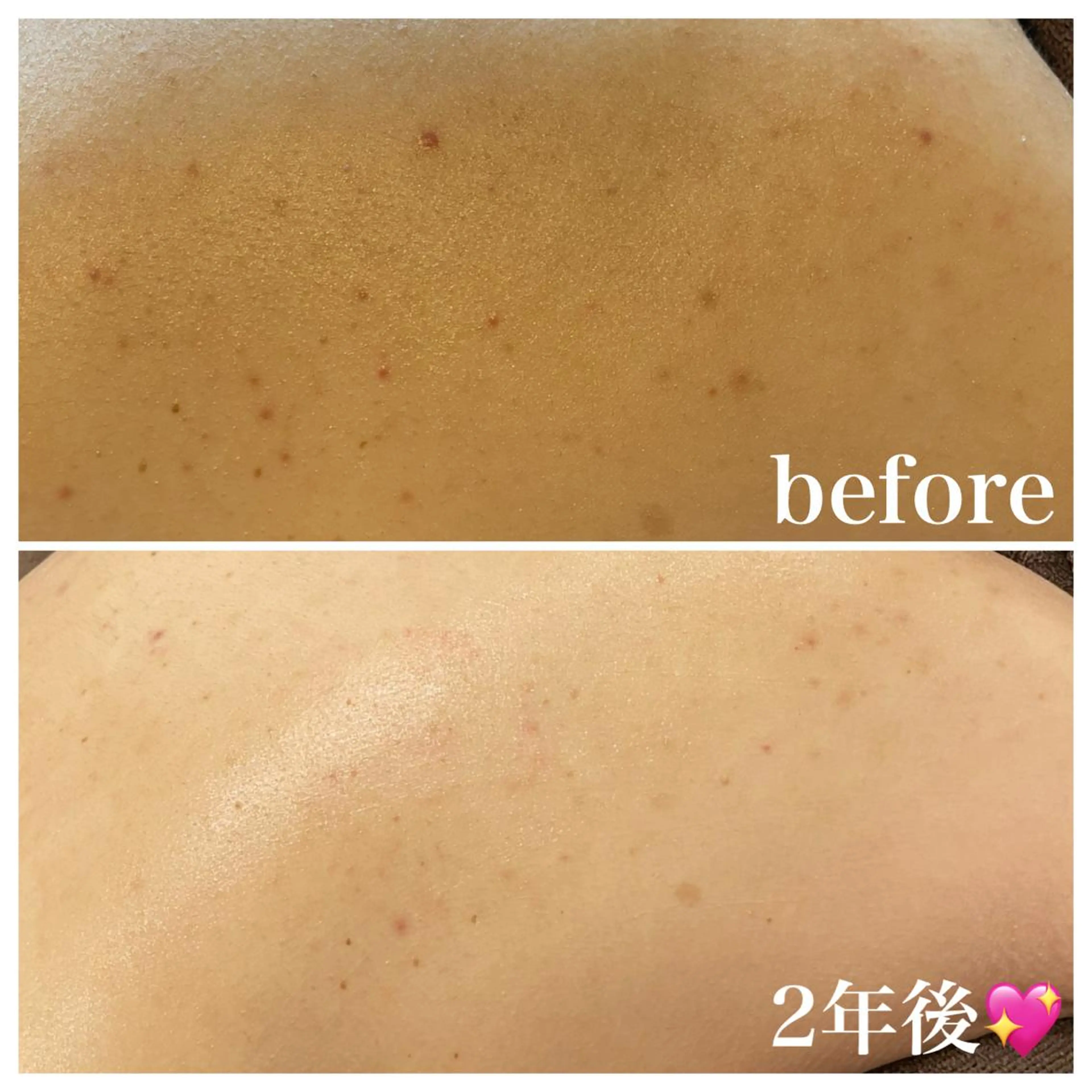 エステ 浜野 恵美のエステ・リラクイメージ