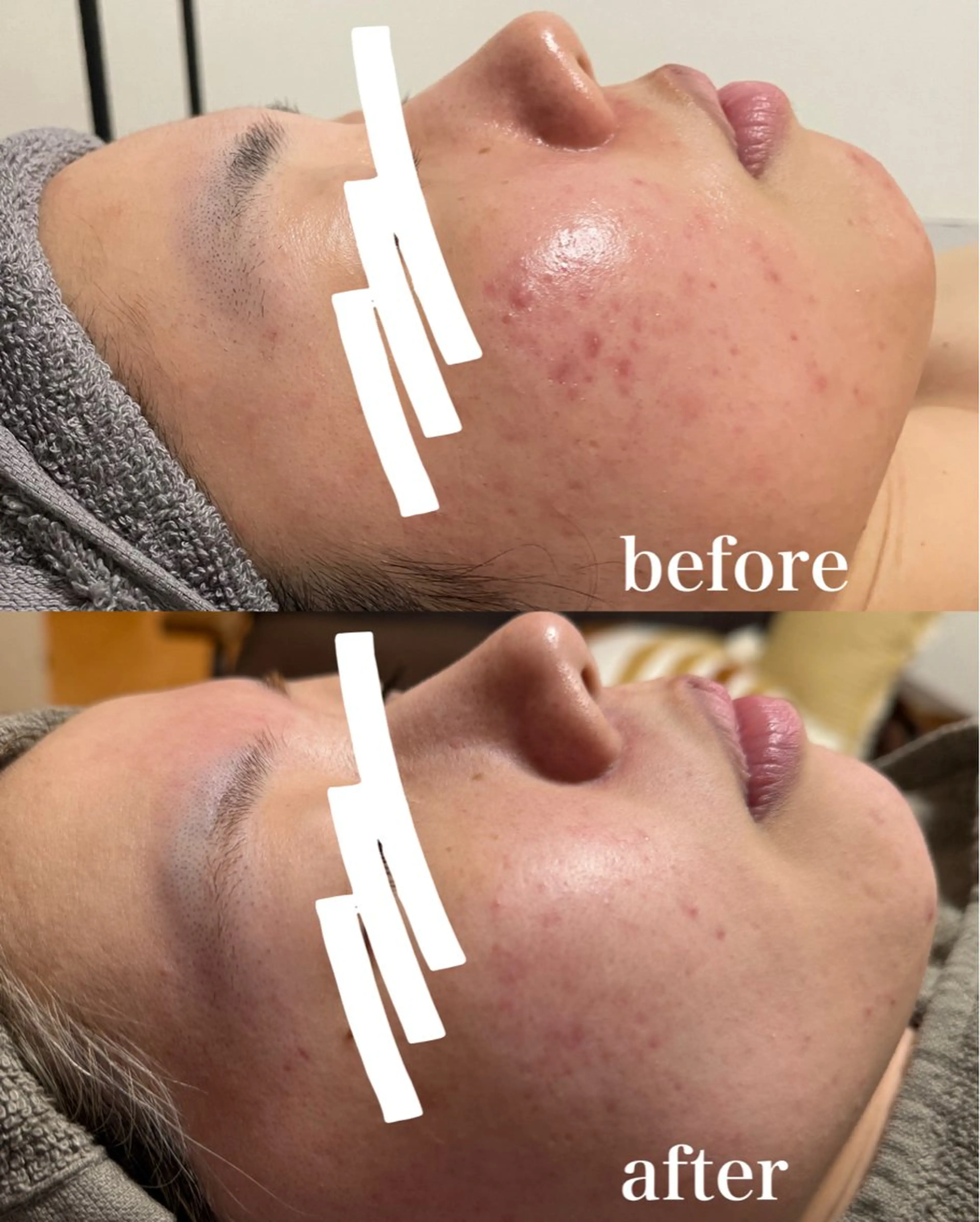 ハーブピーリング専門店lume(ルーム)所属・瀧野 史園のエステ・リラクイメージ