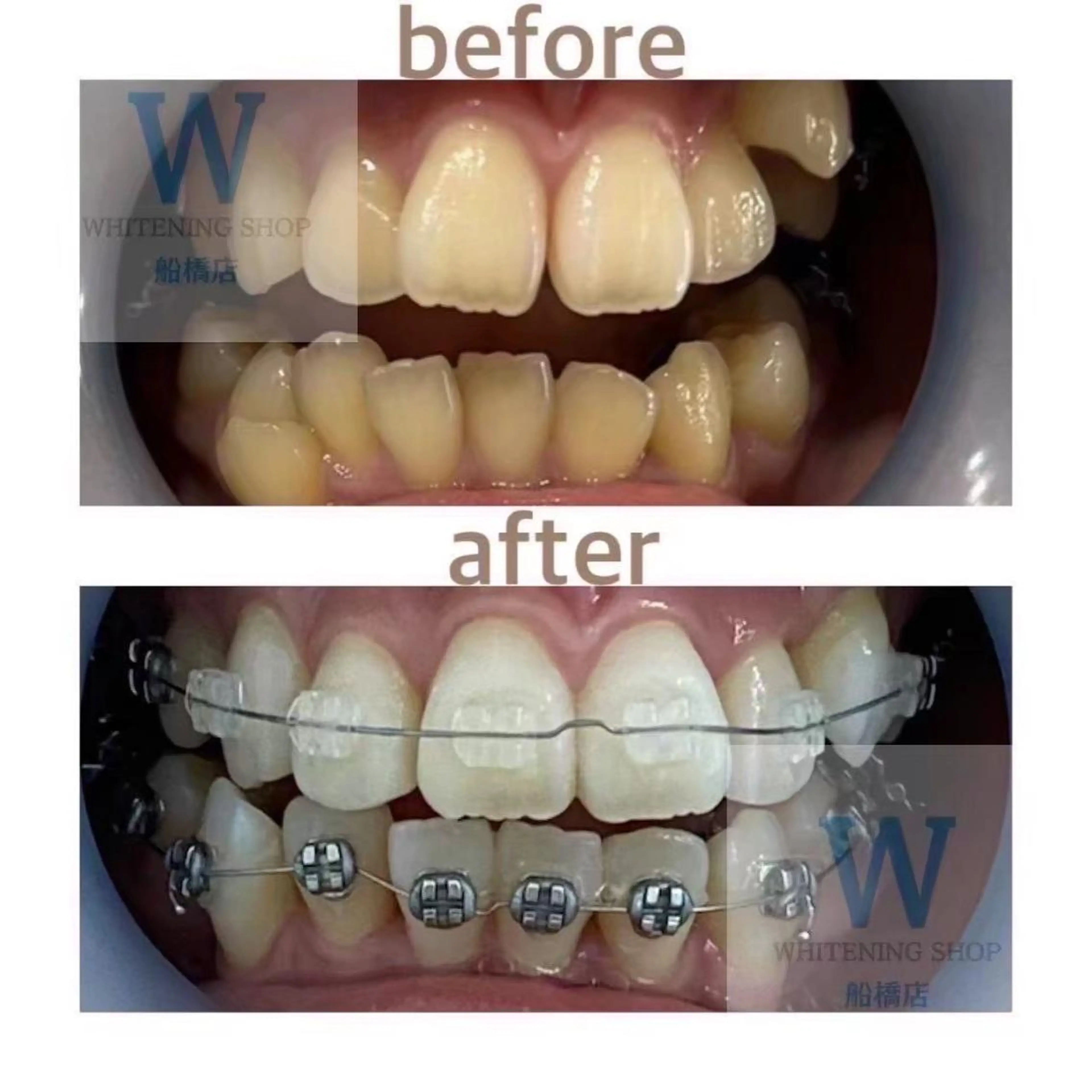 ホワイトニング ショップ船橋店🦷のエステ・リラクイメージ