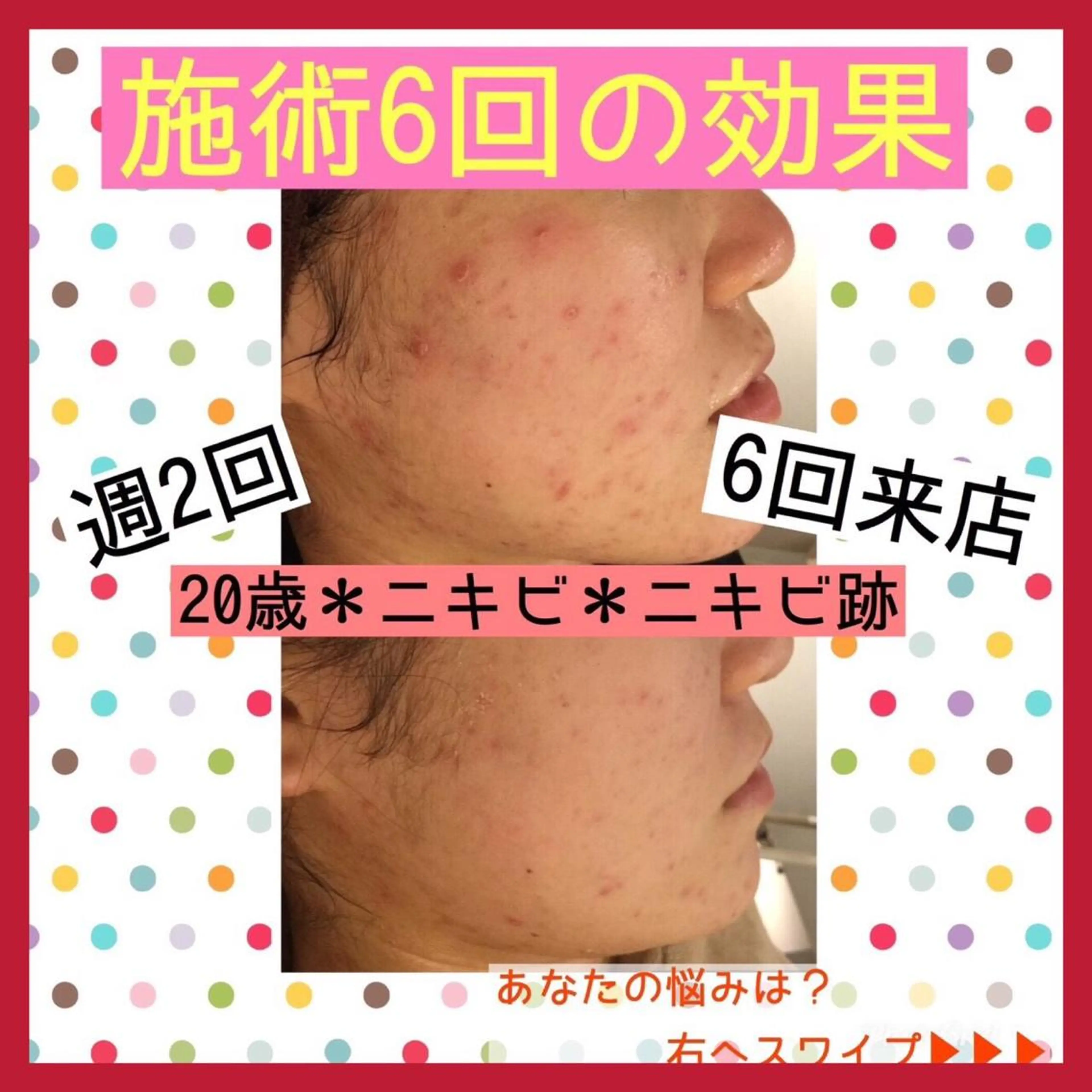 ミディアム パーマ ヘアアレンジ メンズ キッズ ネイル マツエク・マツパ ニキビ・肌質改善専門 ♡人生が変わるサロンのエステ・リラクイメージ