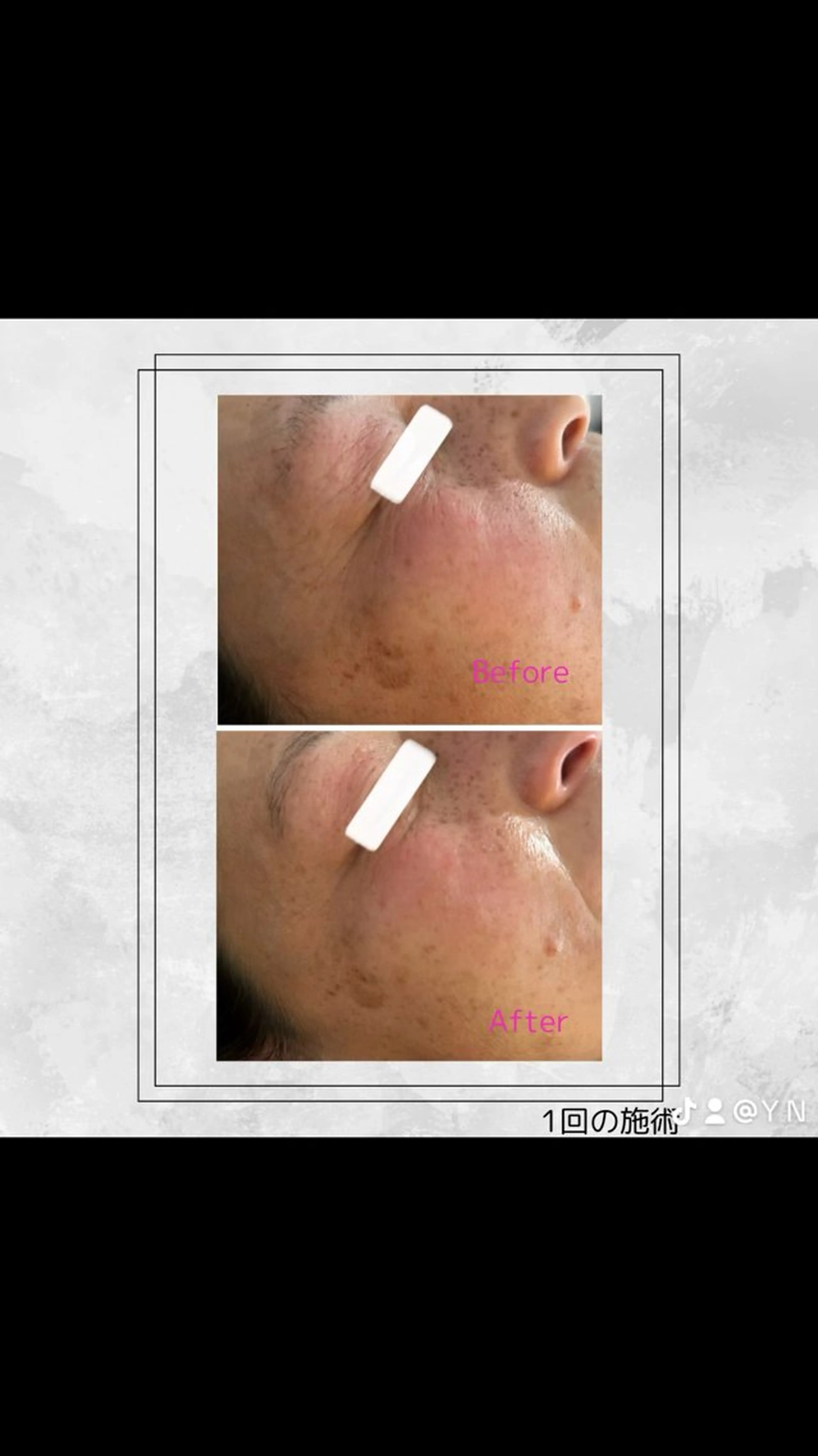 エステ Bijou+幸手店所属・ビジュープラス幸手 由美のエステ・リラクイメージ