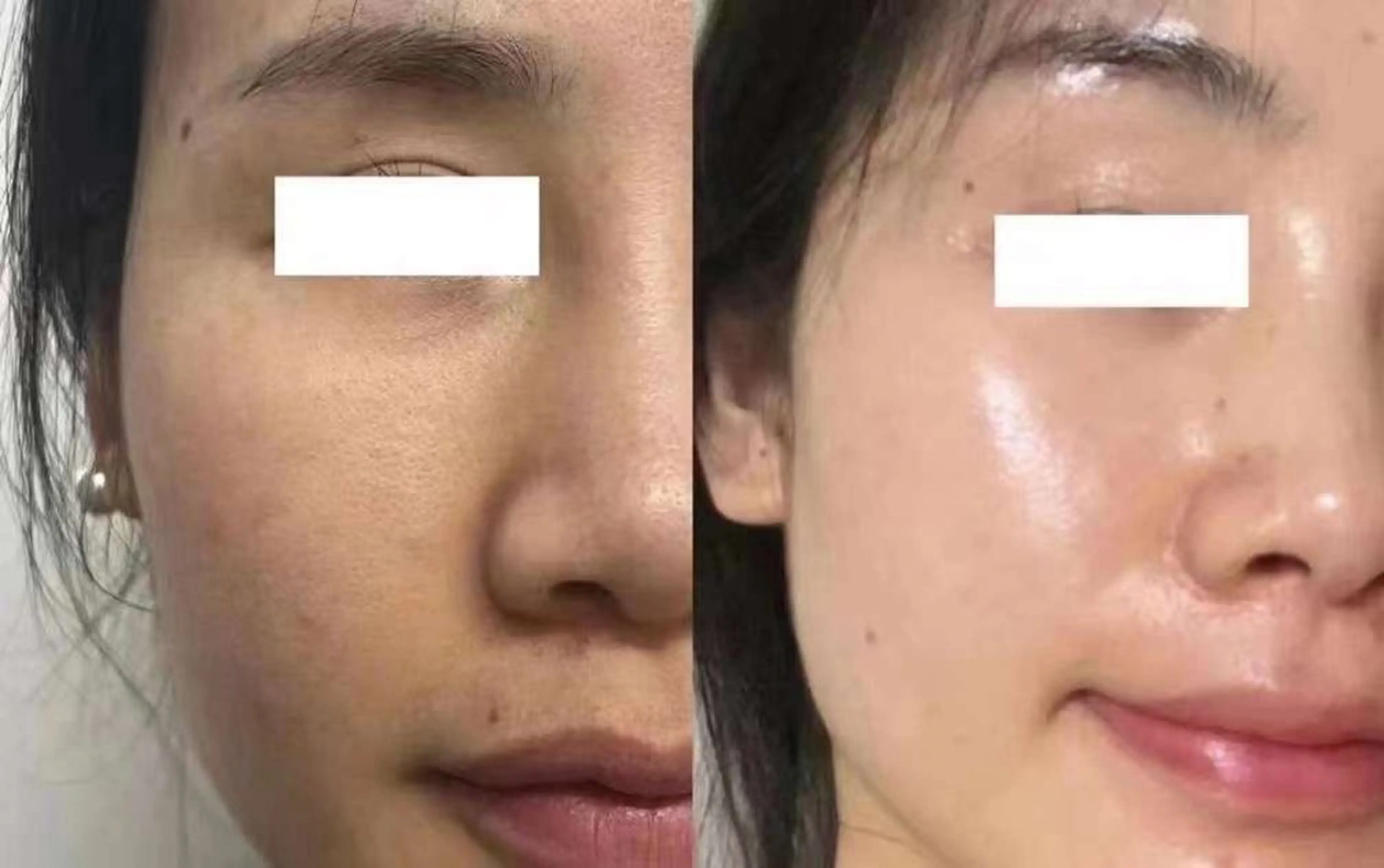 ネイル ブライダルネイル ホワイト エステ aliaハイフ&水光ジェットサロン所属・aliaハーブ水光店 エステティシャン募集のエステ・リラクイメージ