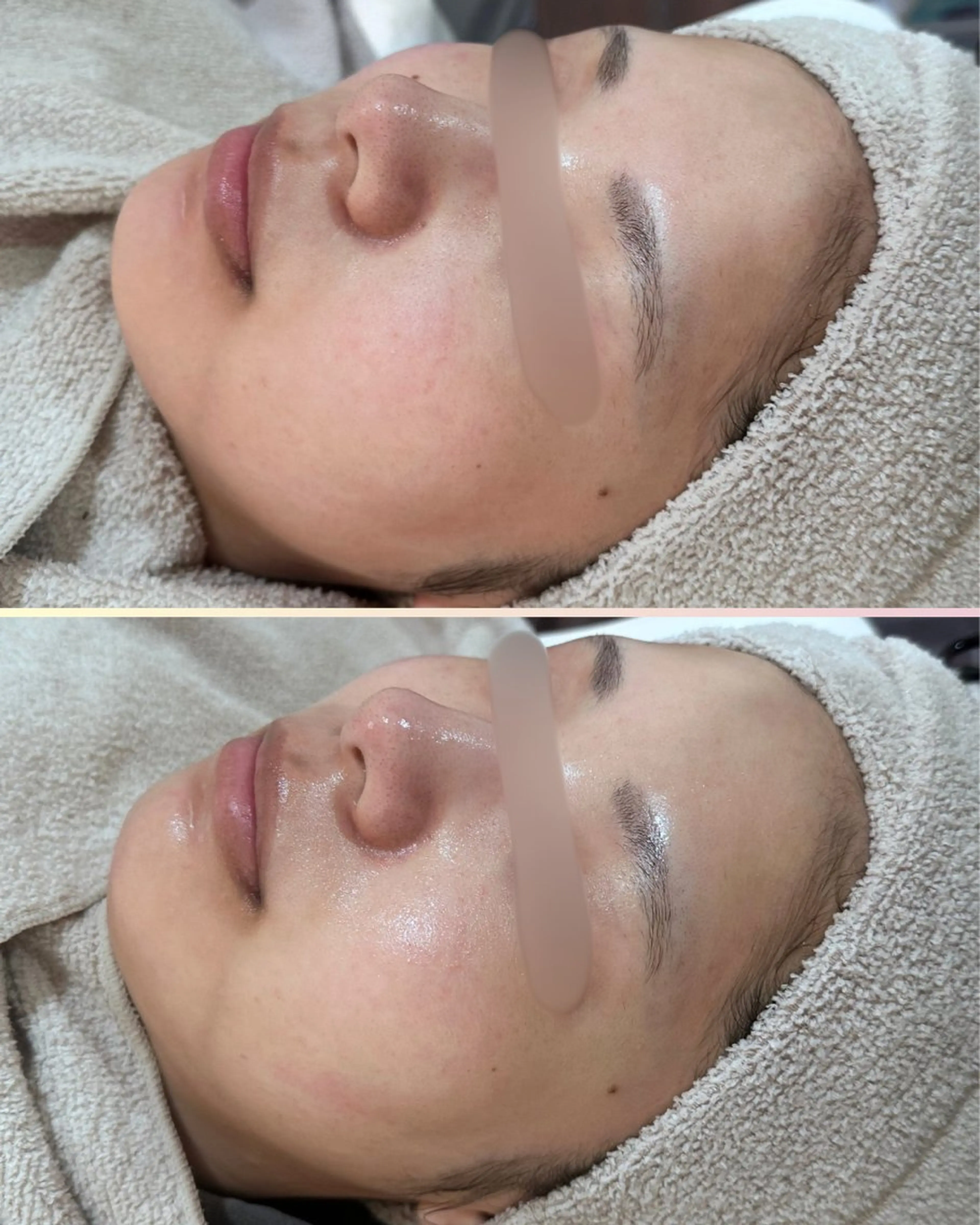 エステ |ピーリング・毛穴| soina神楽坂のエステ・リラクイメージ