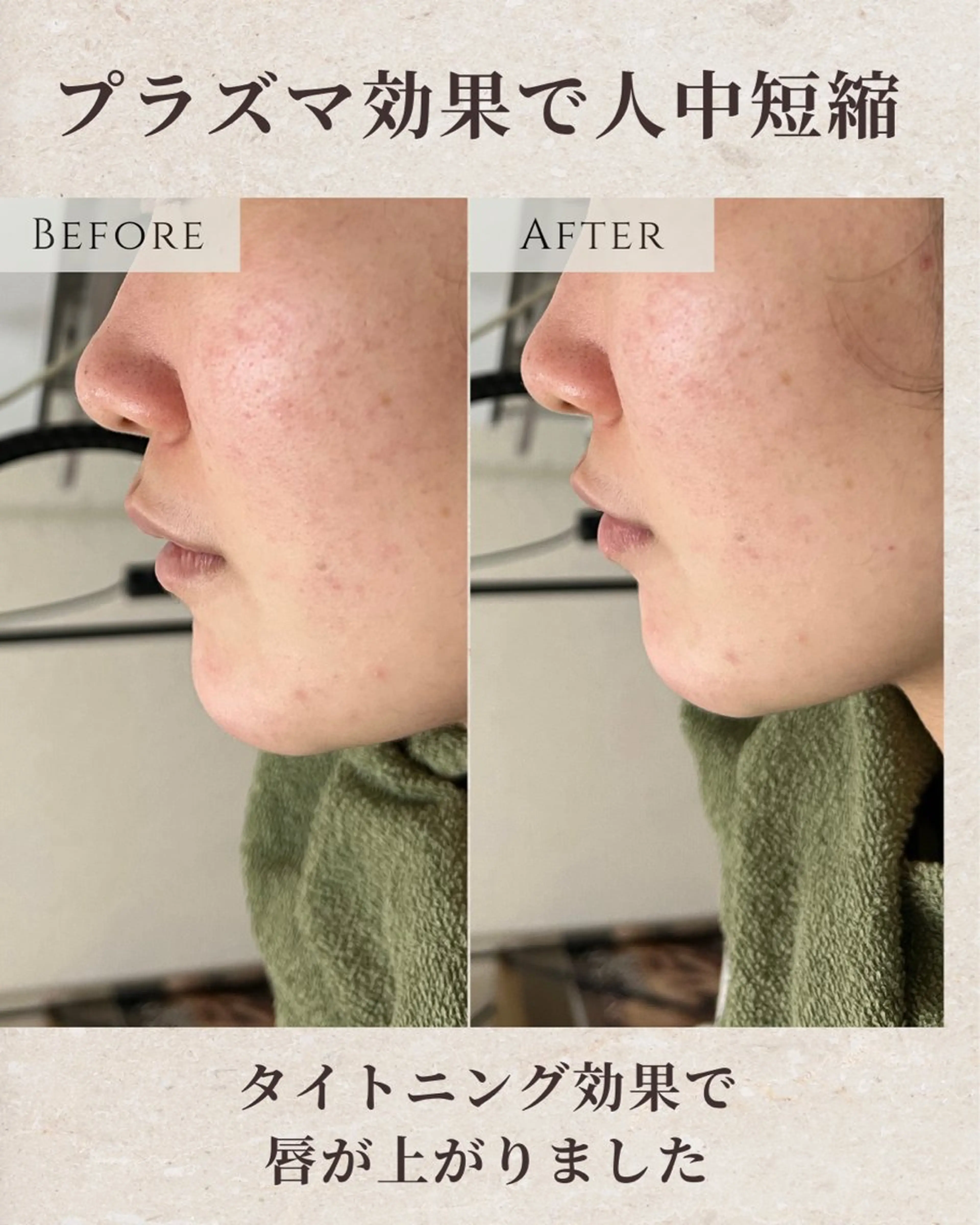 エステ シミ毛穴|眉Wax THE  flowのエステ・リラクイメージ