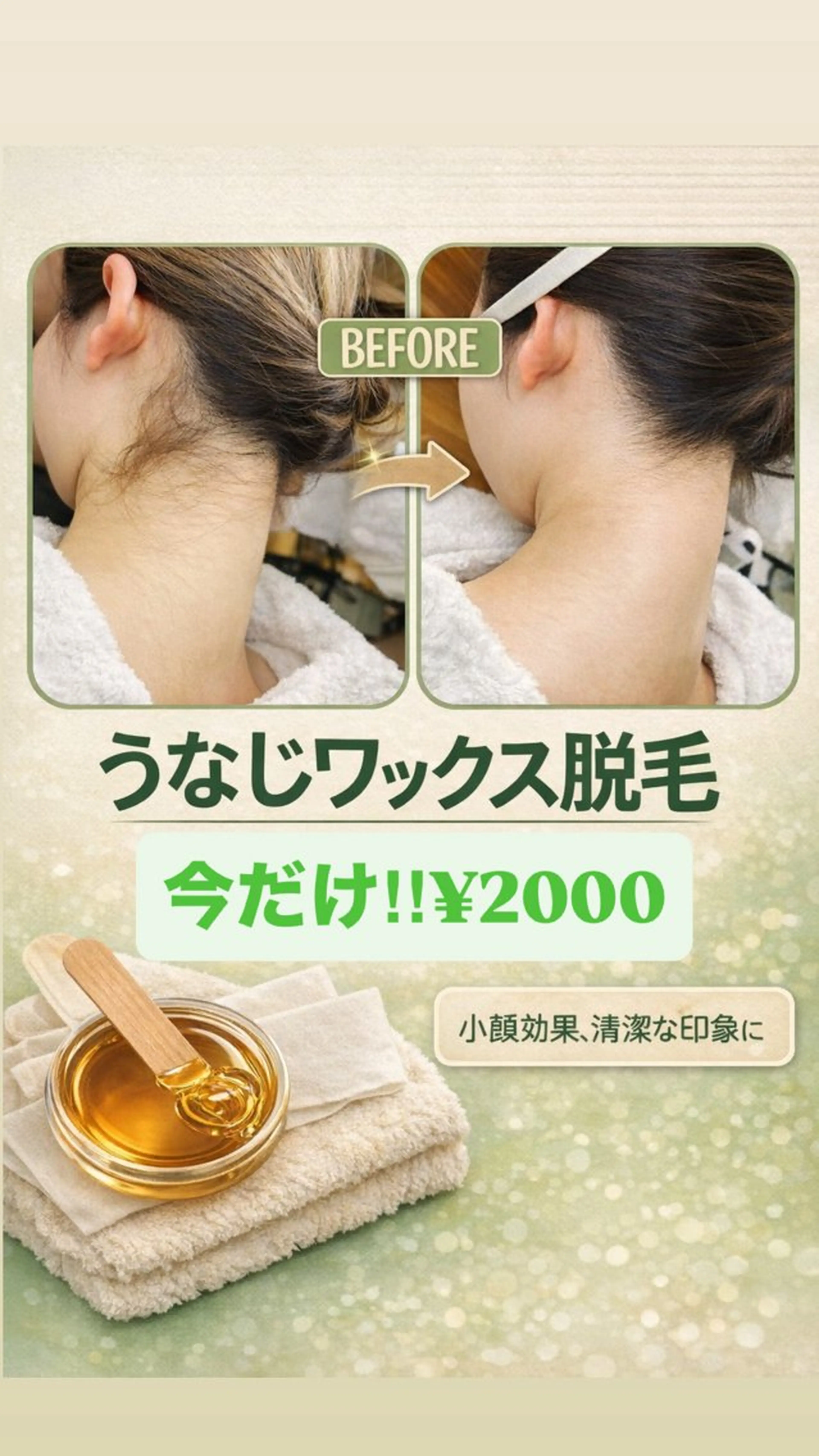 脱毛 エミルカ　自由が丘店所属・ニキビ・ニキビ跡🌿 ハーブピーリング✨のエステ・リラクイメージ