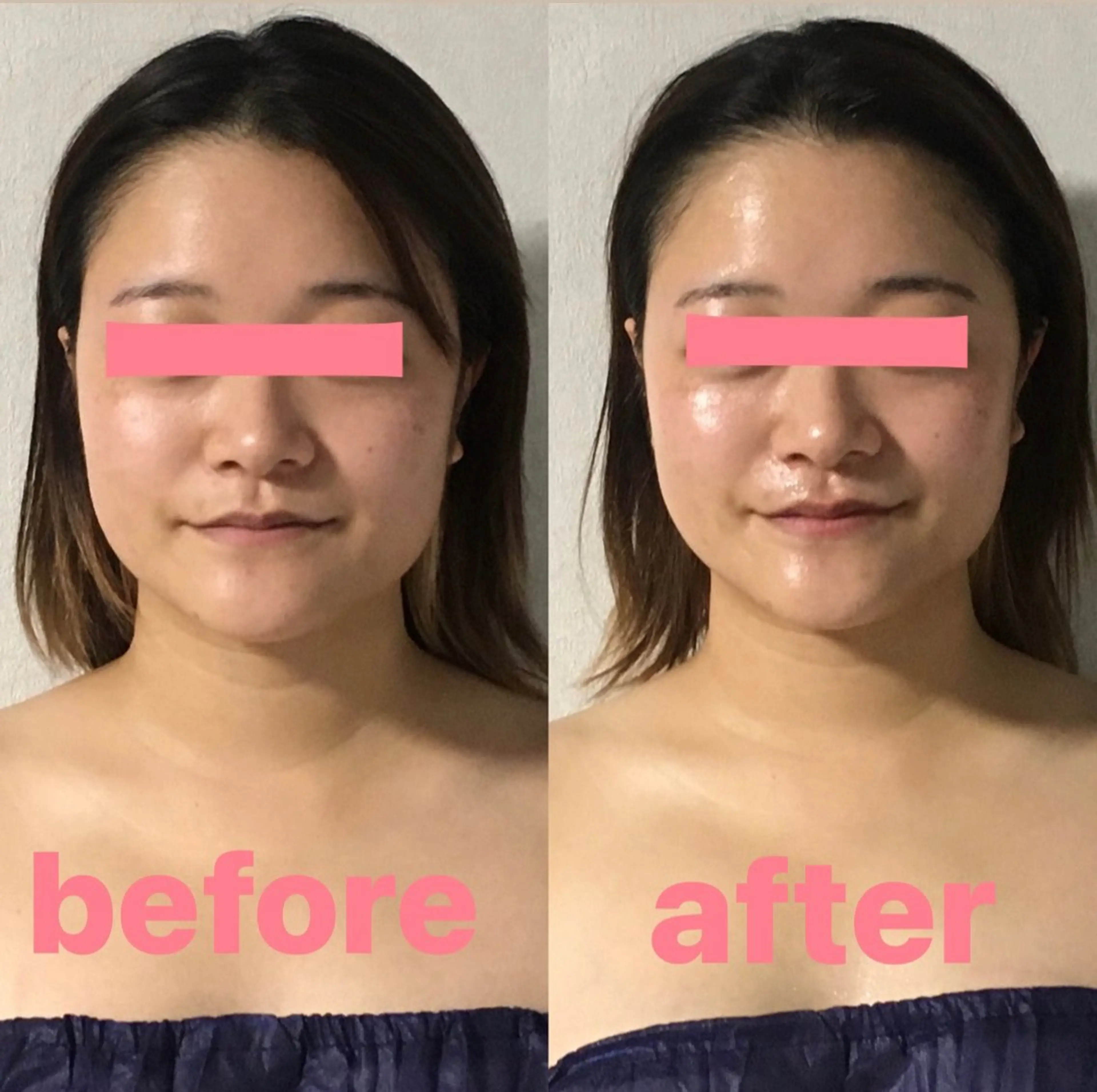 salon de blue rose所属・ハイパーナイフ専門 熊田陽子のエステ・リラクイメージ