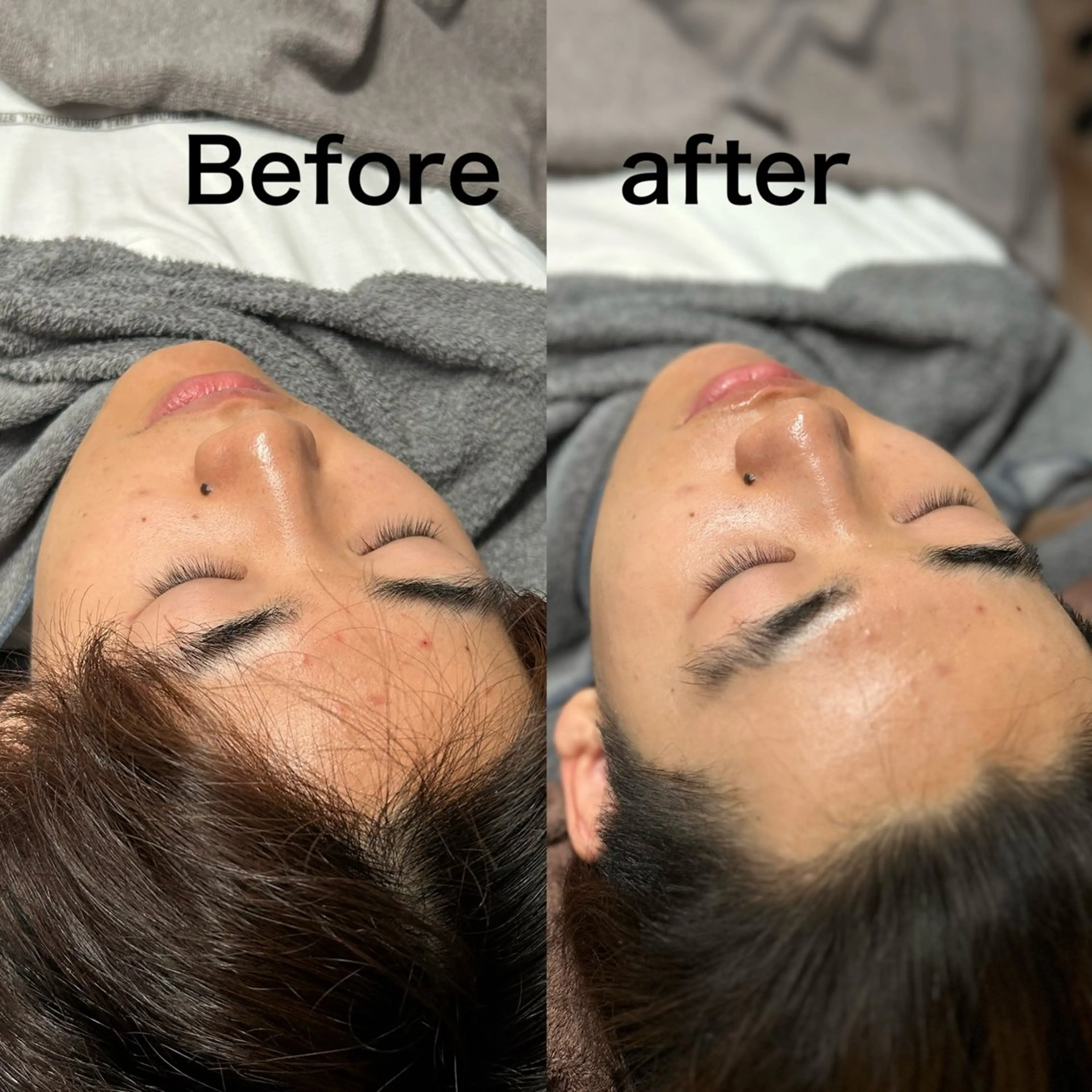 エステ Smoo アユミの眉毛・アイブロウイメージ