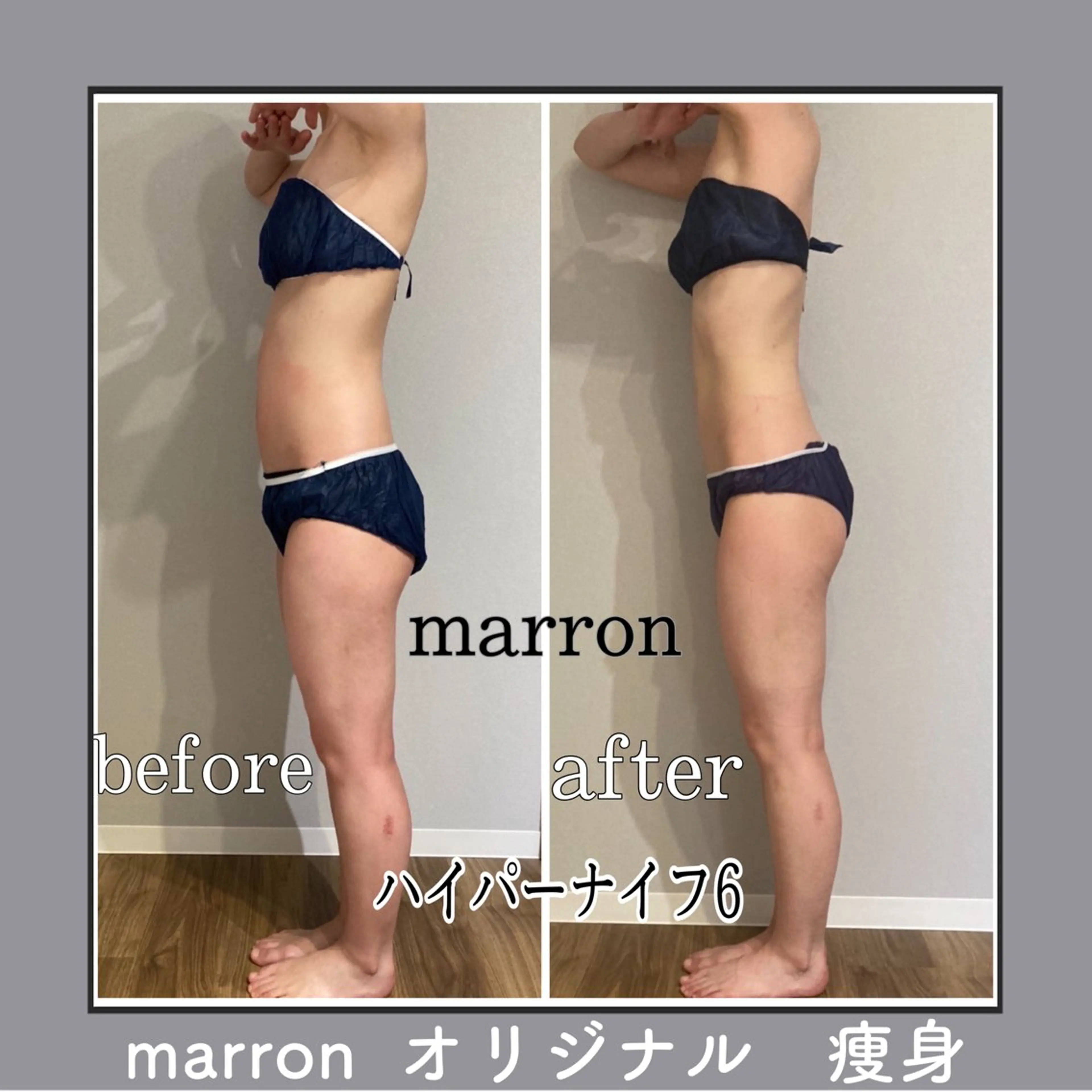 marron所属・痩身ハイパーナイフ ララピールリアボーテのエステ・リラクイメージ