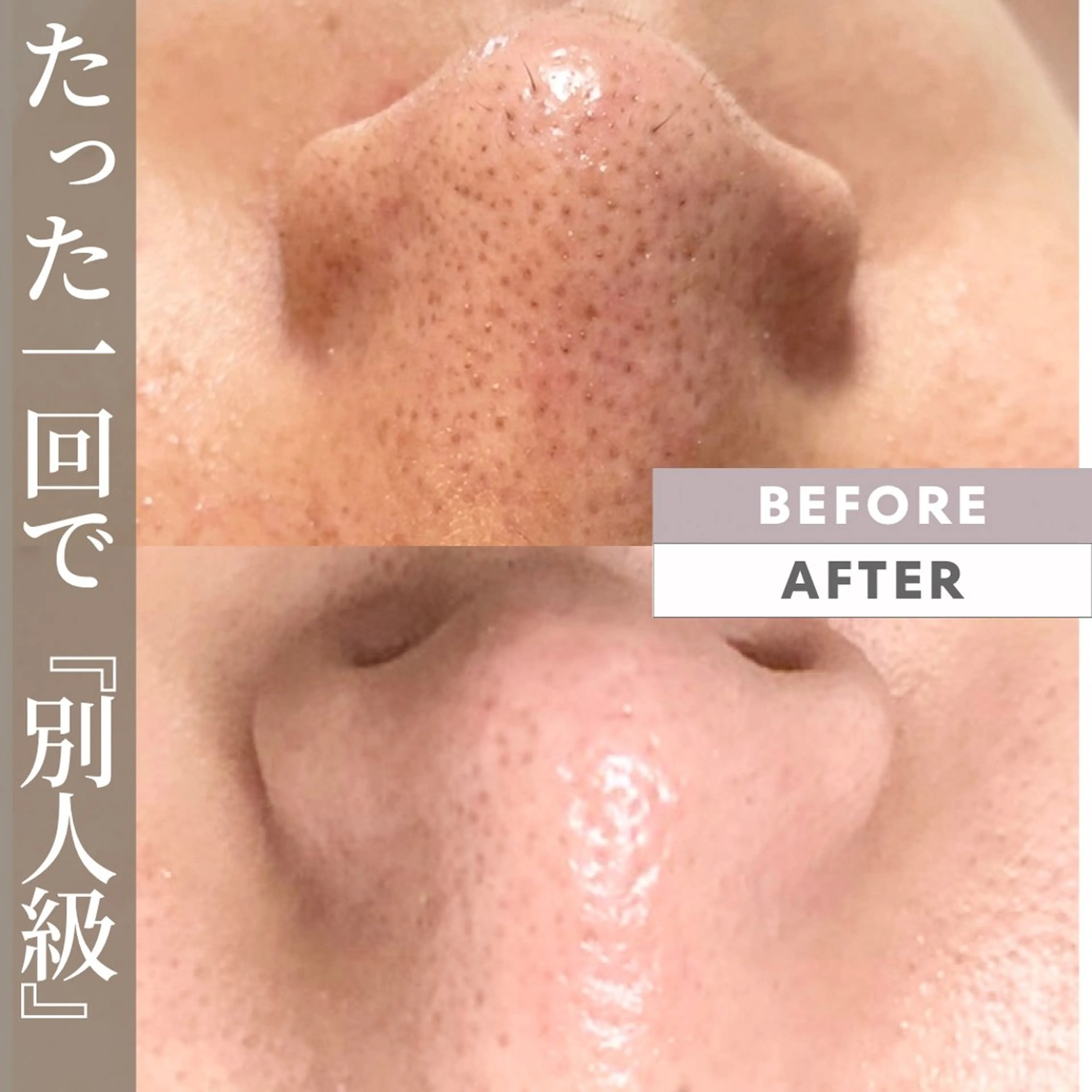 毛穴レス肌、皮脂詰まり、黒ずみ、しみ、しわ→韓国女優陶器肌❤︎60分　¥7640の写真