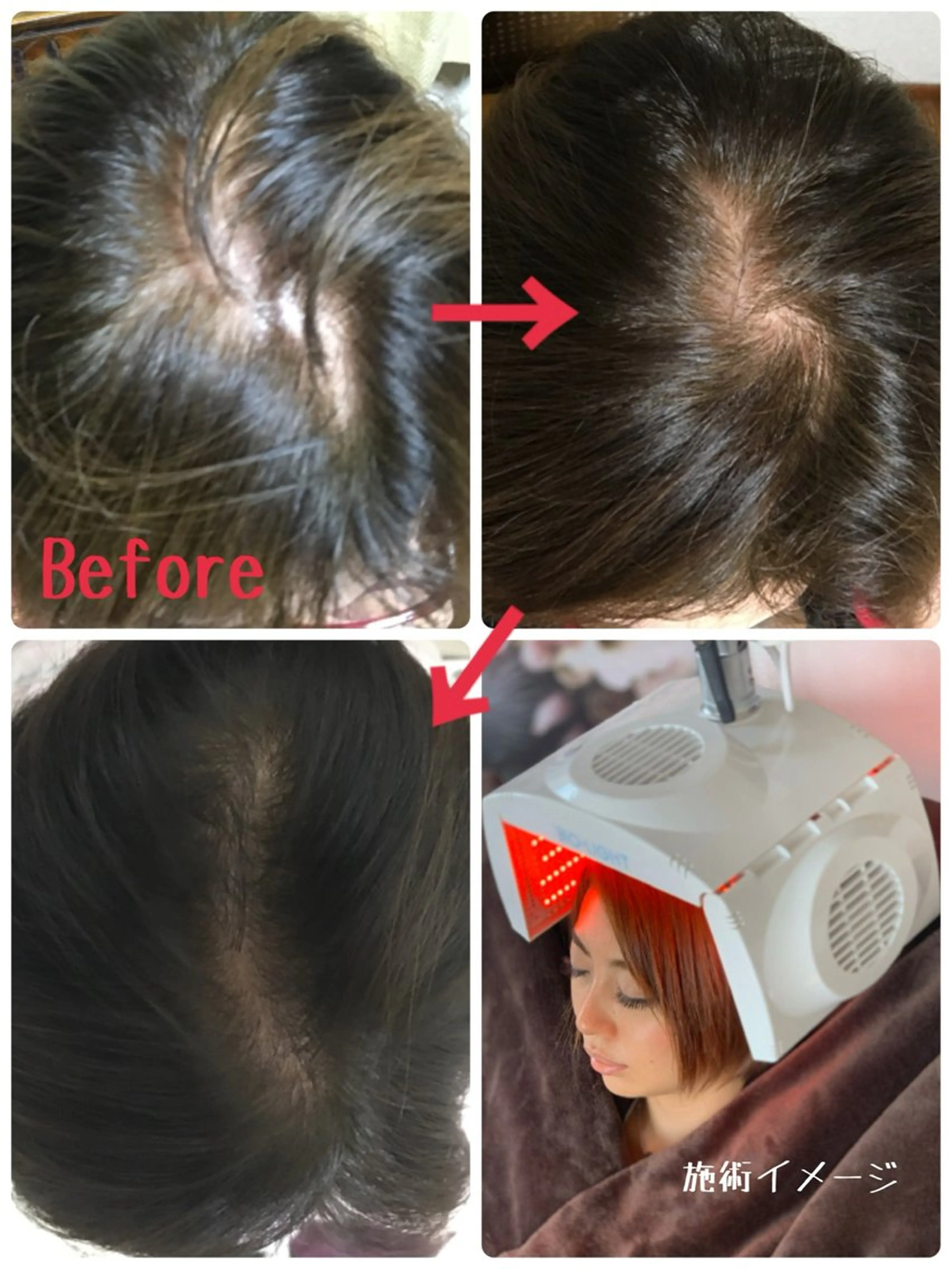 KalanDiva〜 ｶﾗﾝﾃﾞｨｰﾊﾞ〜のエステ・リラクイメージ