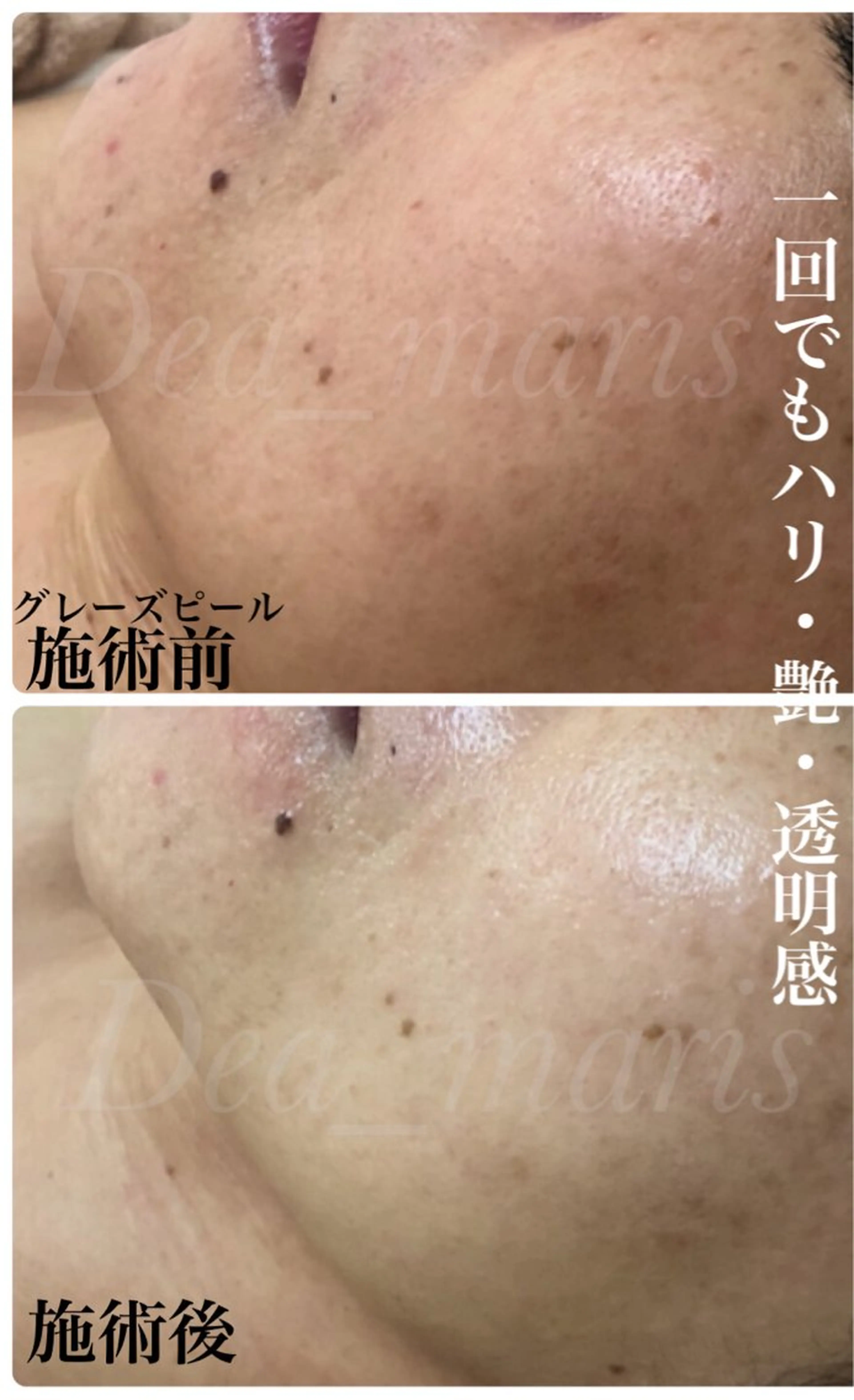 private salon  Dea_maris シュガーリング＆パーソナルボディケア所属・シミ改善・韓国肌管理 ボディメイク痩身のその他イメージ