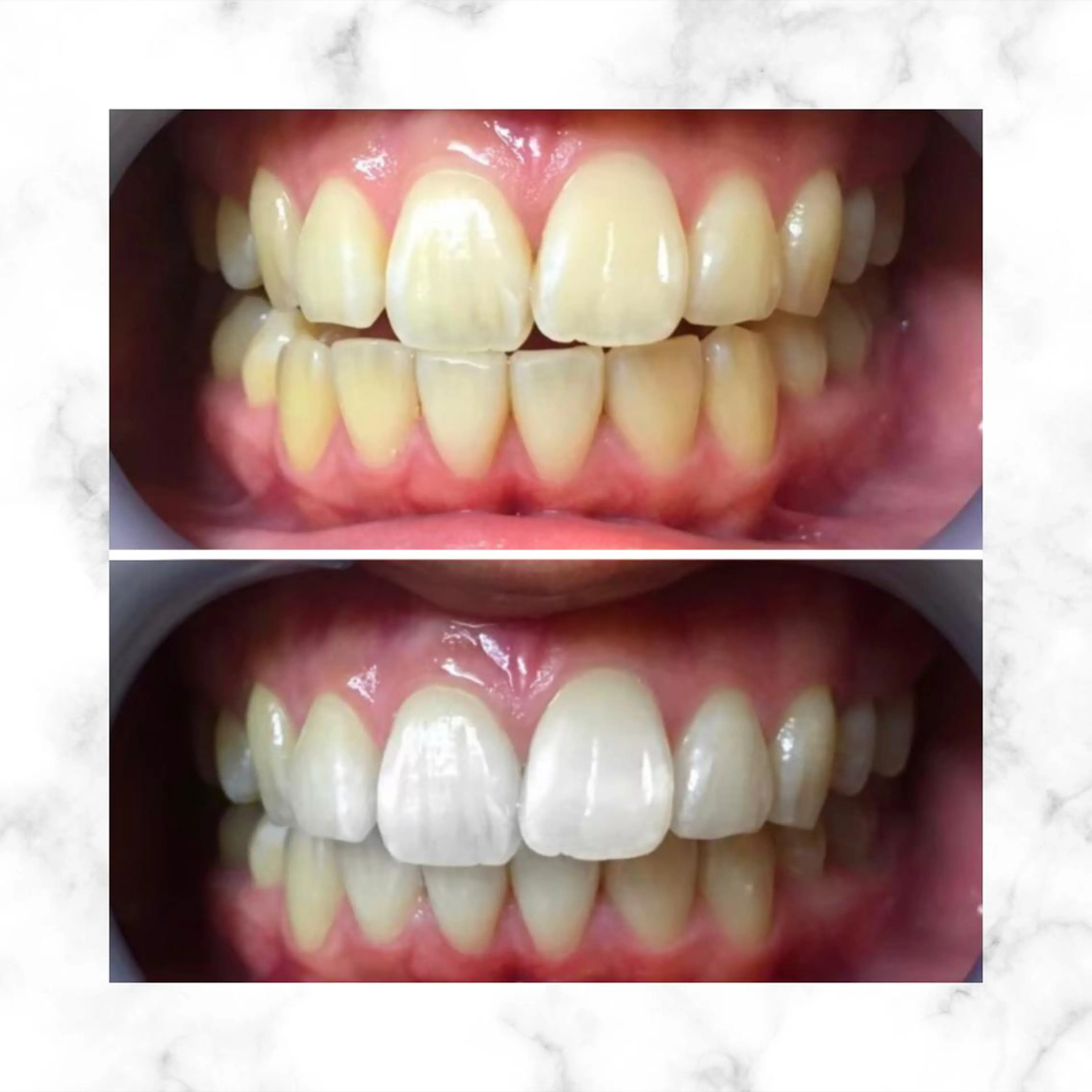 LBSホワイトニング 🌐渋谷店スタッフのエステ・リラクイメージ