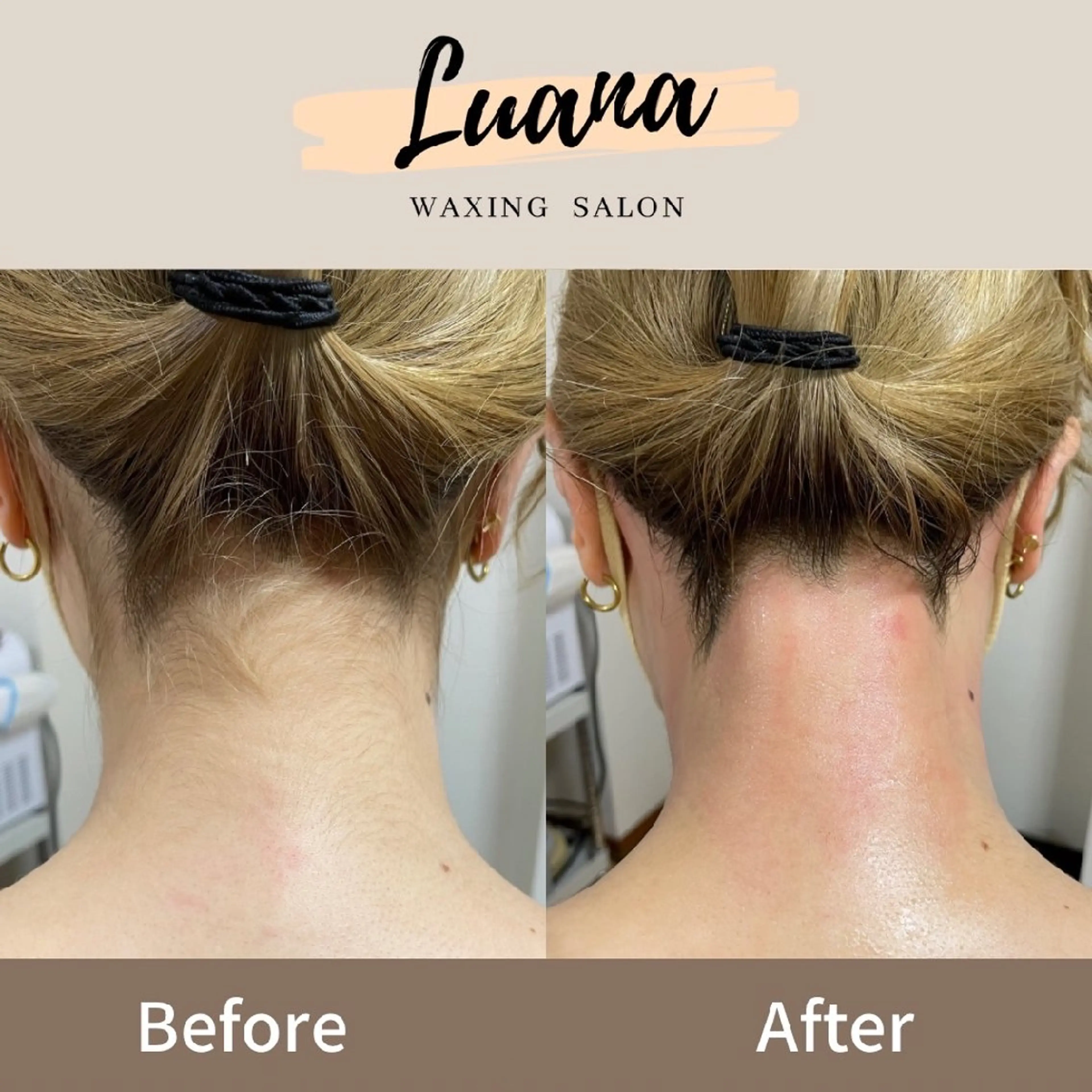 脱毛 Luana waxing salon所属・Luana wax 🐚根本のエステ・リラクイメージ