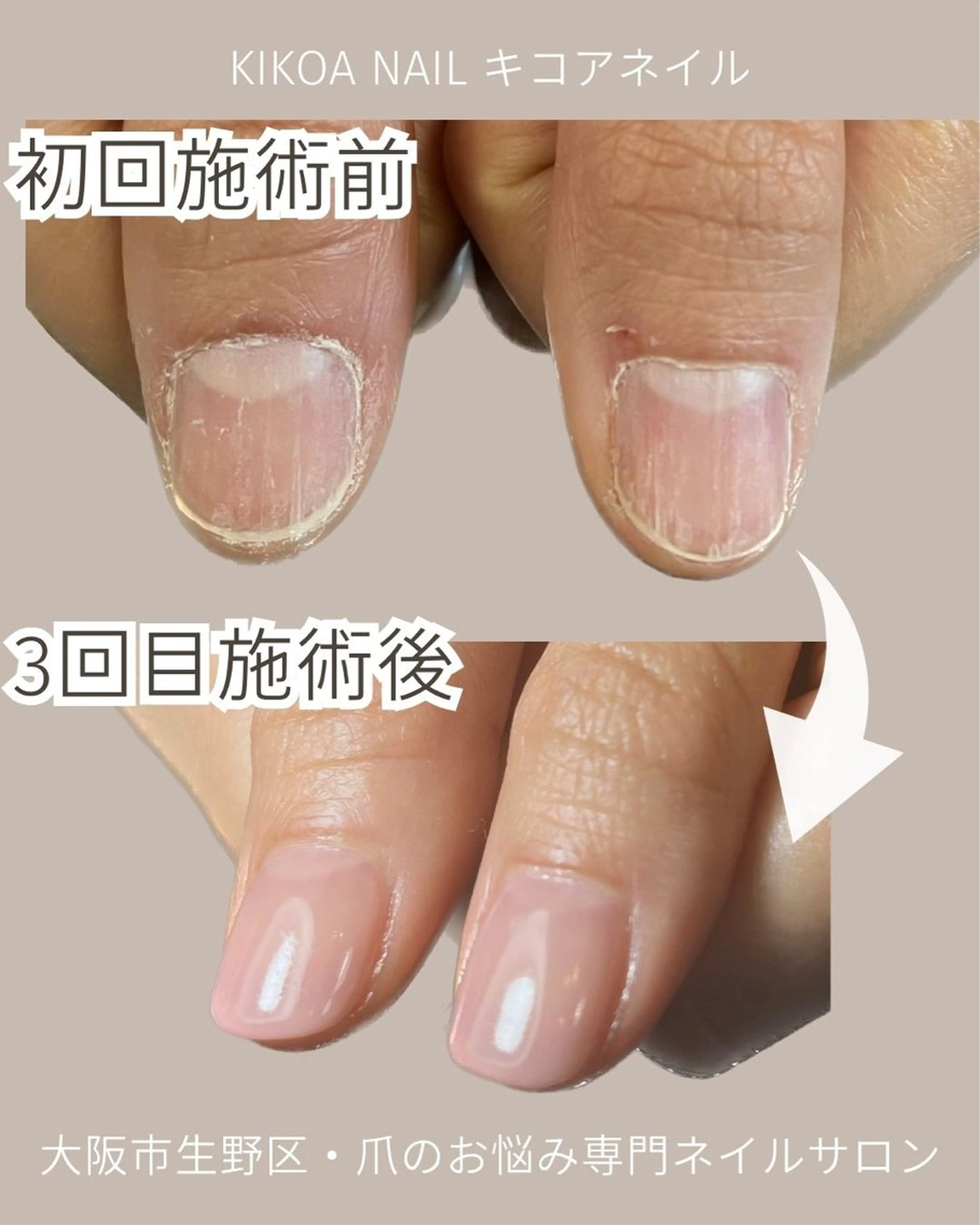 ネイル KIKOA NAIL キコアネイルのネイルデザイン