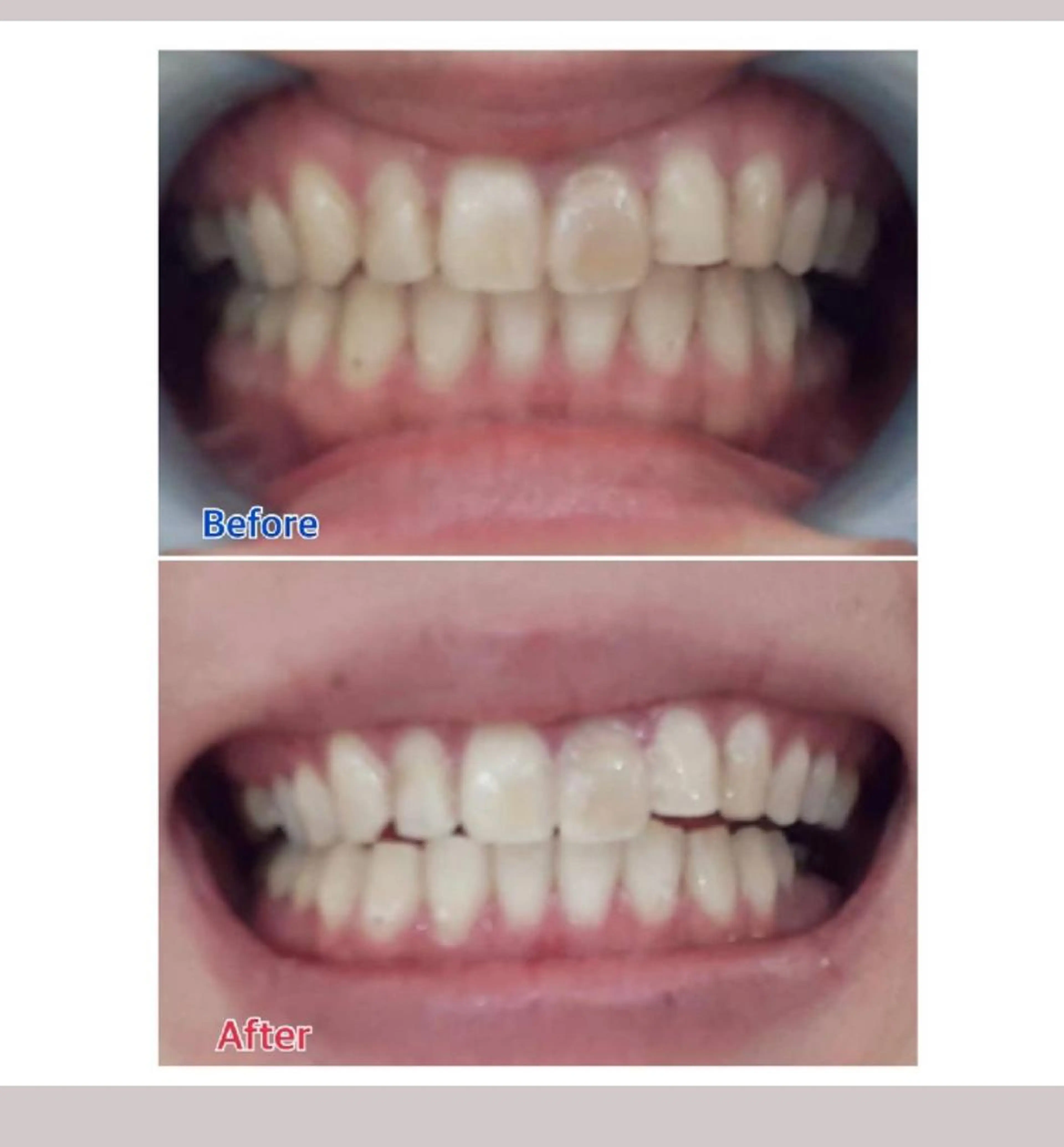 M渋谷店所属・M渋谷 ホワイトニングのエステ・リラクイメージ