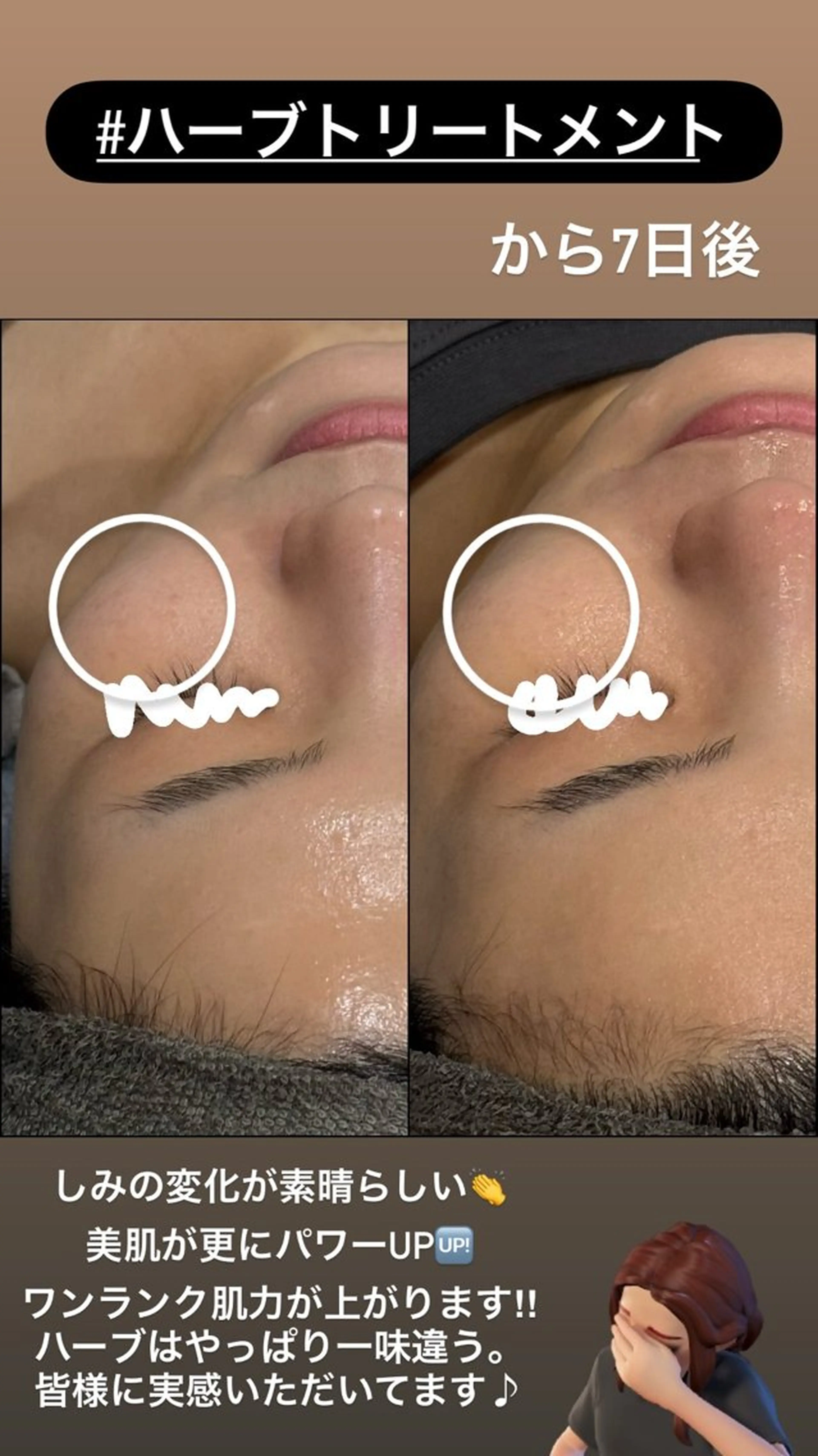 エステ LiZA エステティックサロンのエステ・リラクイメージ