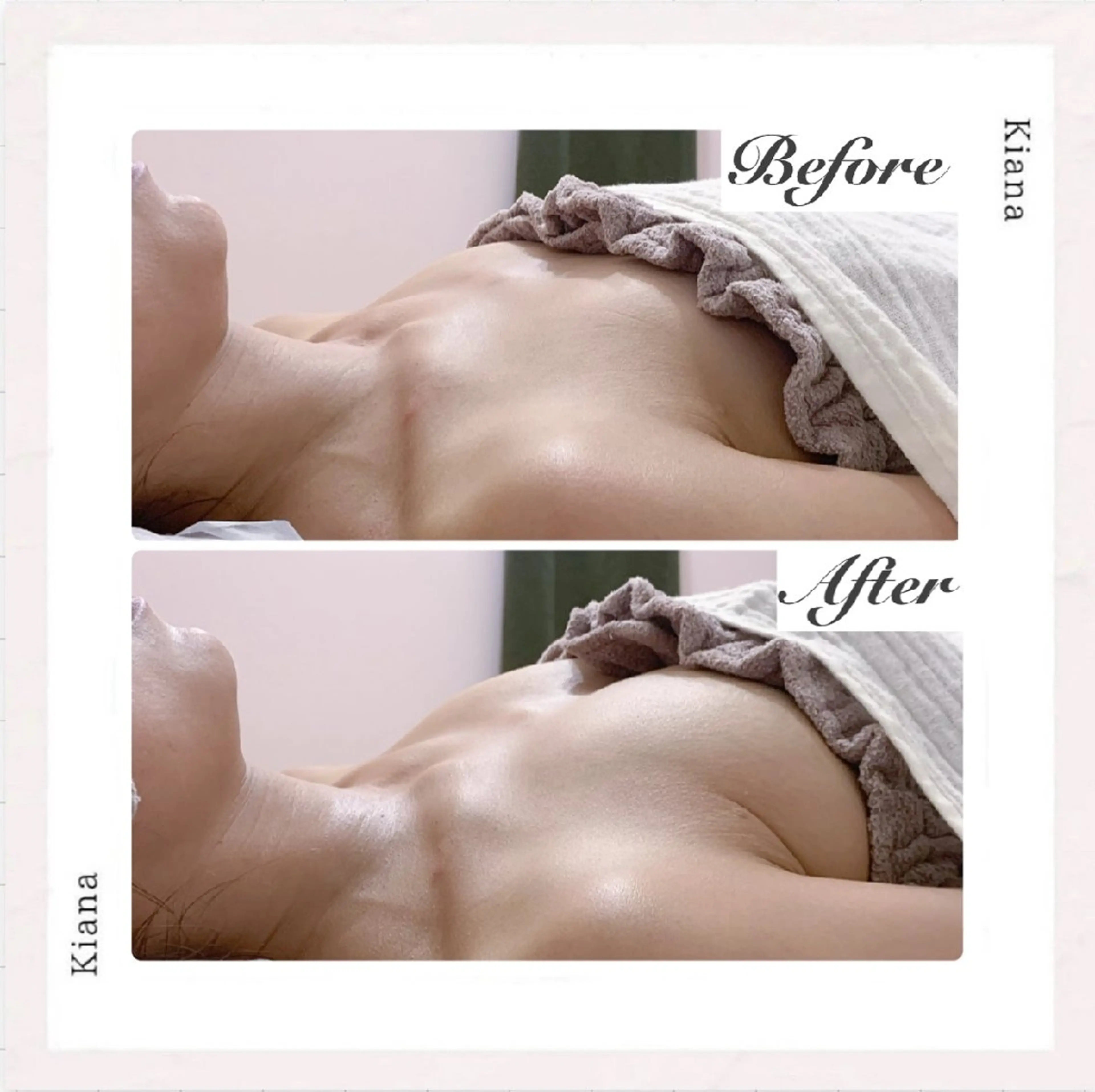 エステ リラク 【バスト専門店 】 Kiana のエステ・リラクイメージ