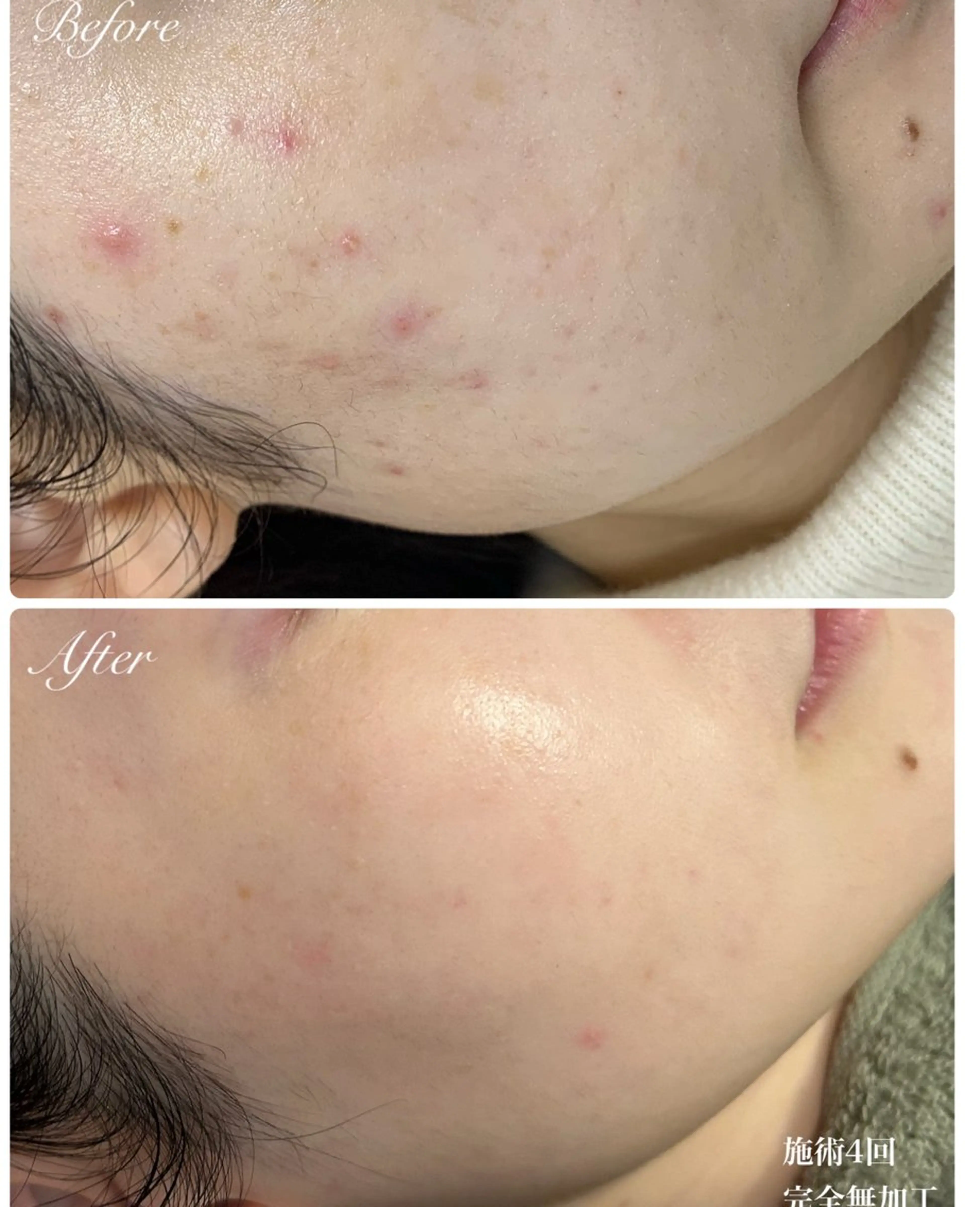 estheticsalon Pleroma【プレローマ】所属・【脱毛･美肌サロン】 Pleromaのエステ・リラクイメージ