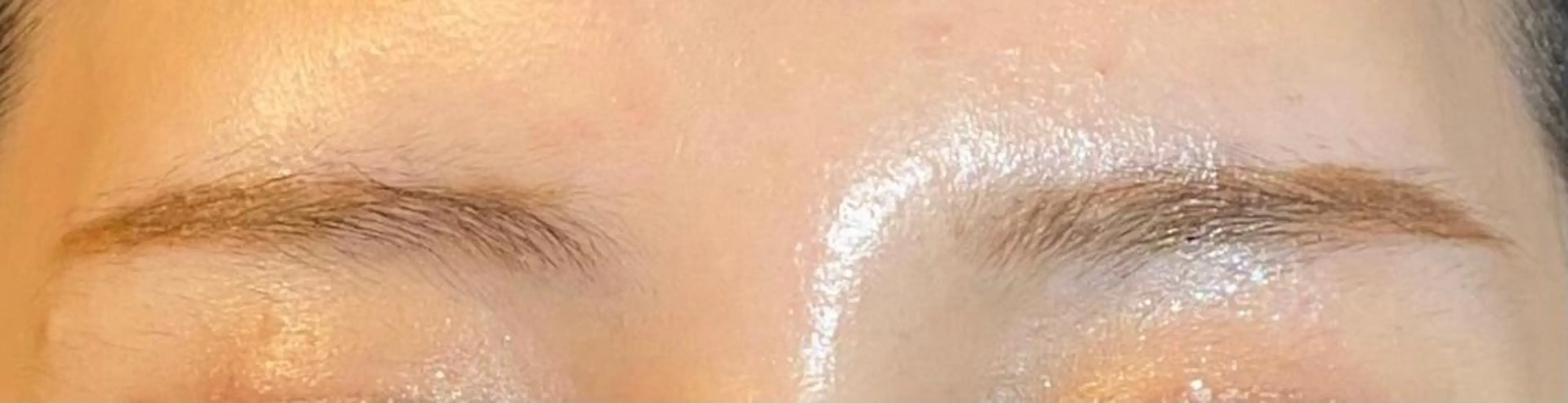 ハーブピーリング/韓国肌管理/フェイシャル/毛穴洗浄/眉毛/顔脱毛【糸脱毛専門】rev所属・ハーブピーリング🌹 毛穴洗浄❤️眉waxのエステ・リラクイメージ