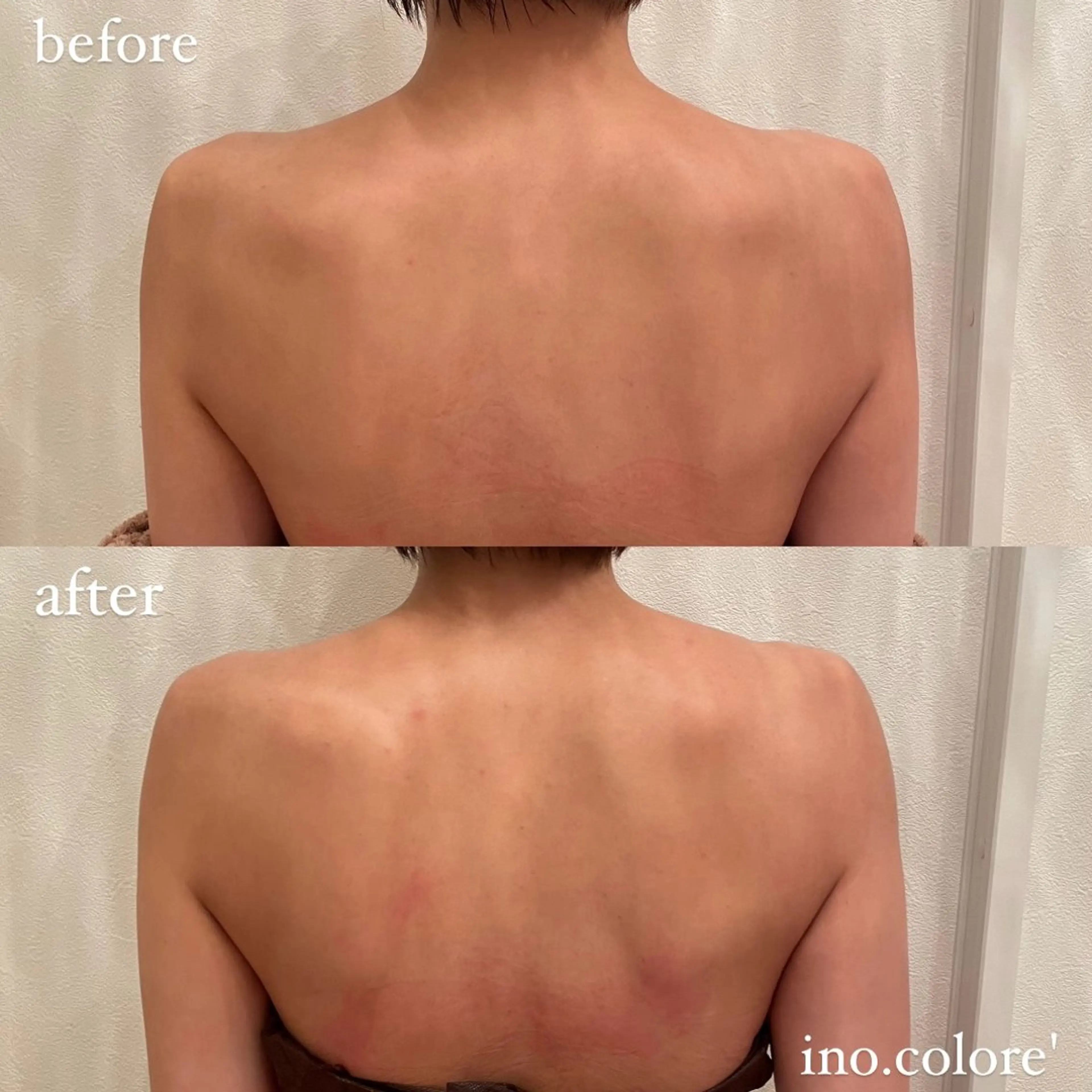 エステ リラク エステサロンino.colore'所属・小顔サロン ino.coloreのエステ・リラクイメージ