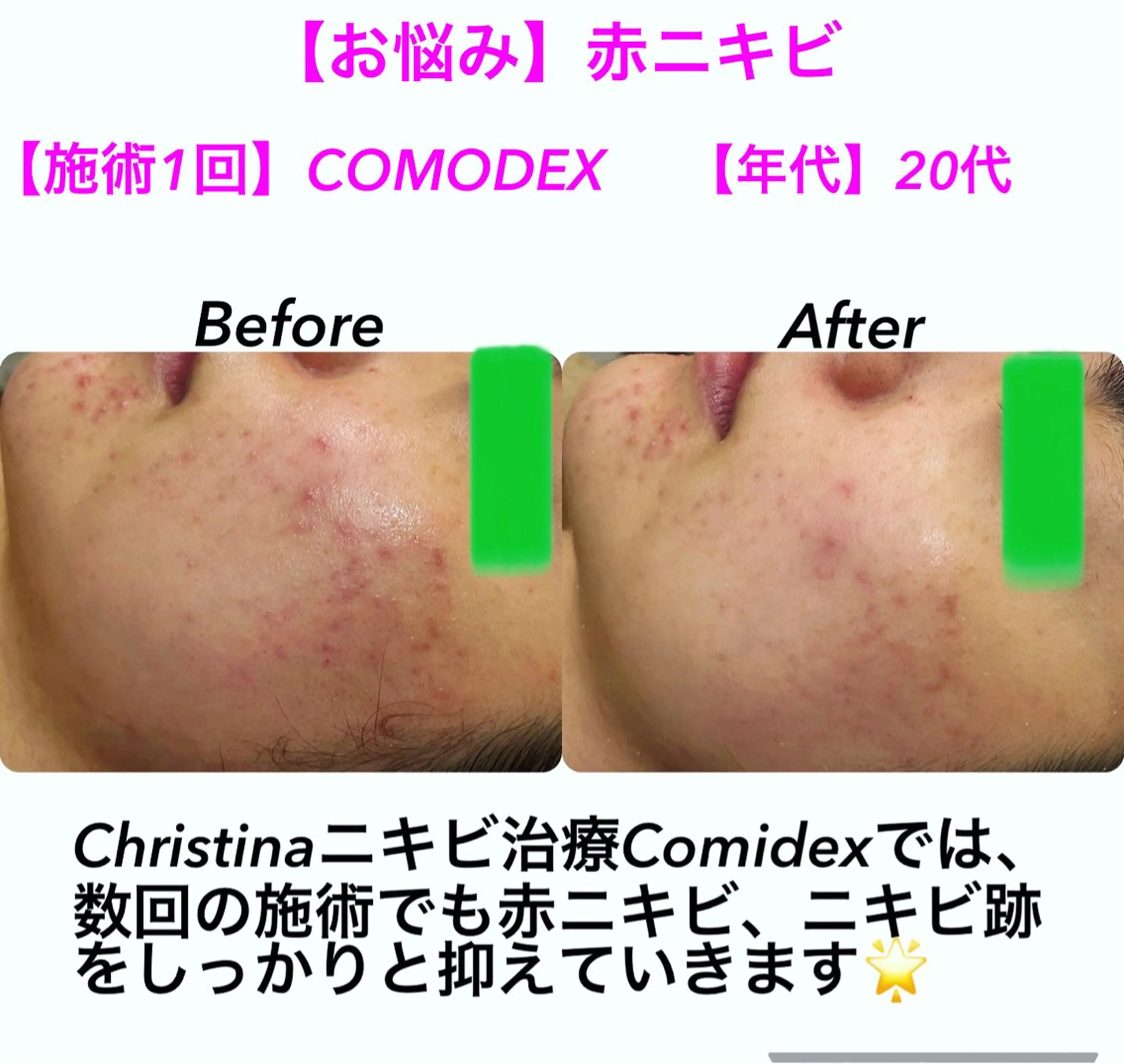 小顔&美肌品川店 Masqueradeのエステ・リラクイメージ