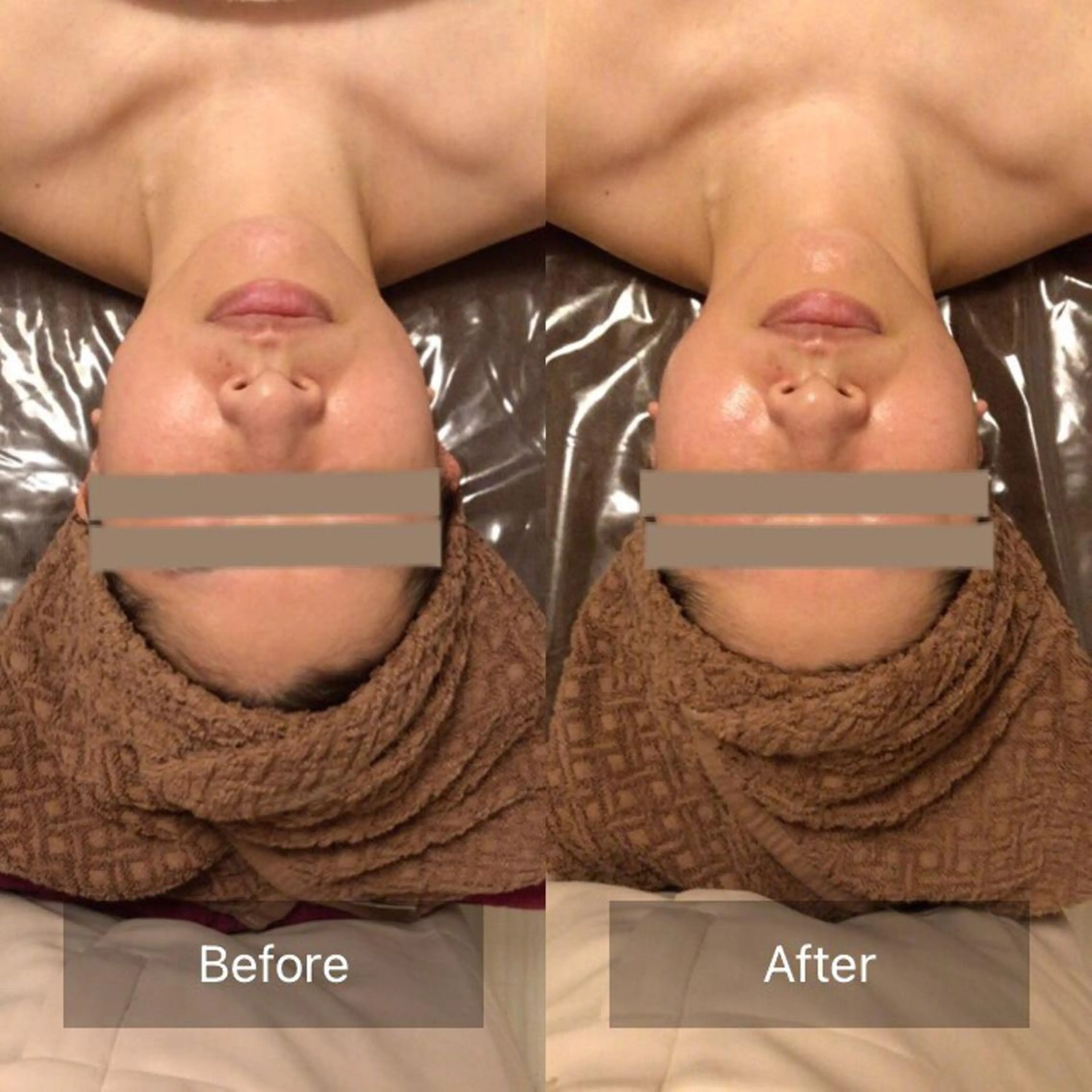 小顔🌼💕肌質改善 SalonBelleのエステ・リラクイメージ