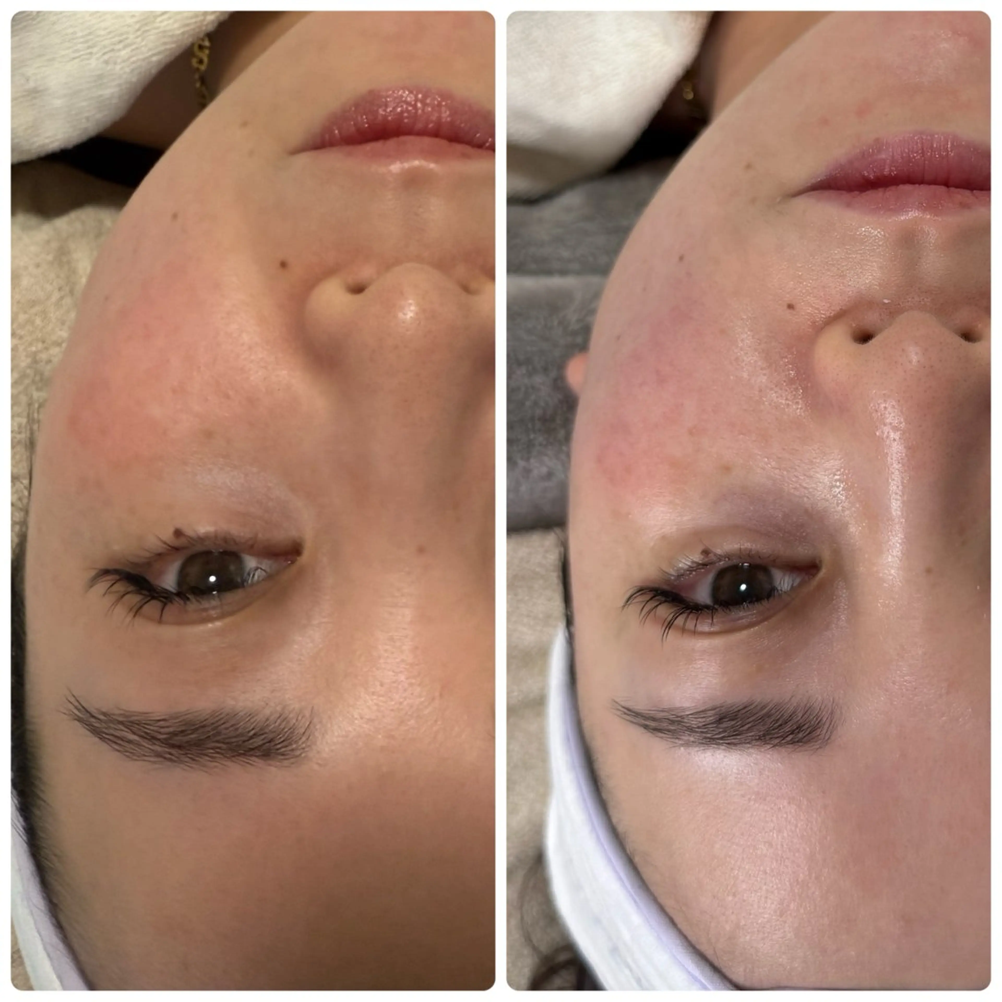 【👩‍🎓学割】フェイシャルワックスの写真