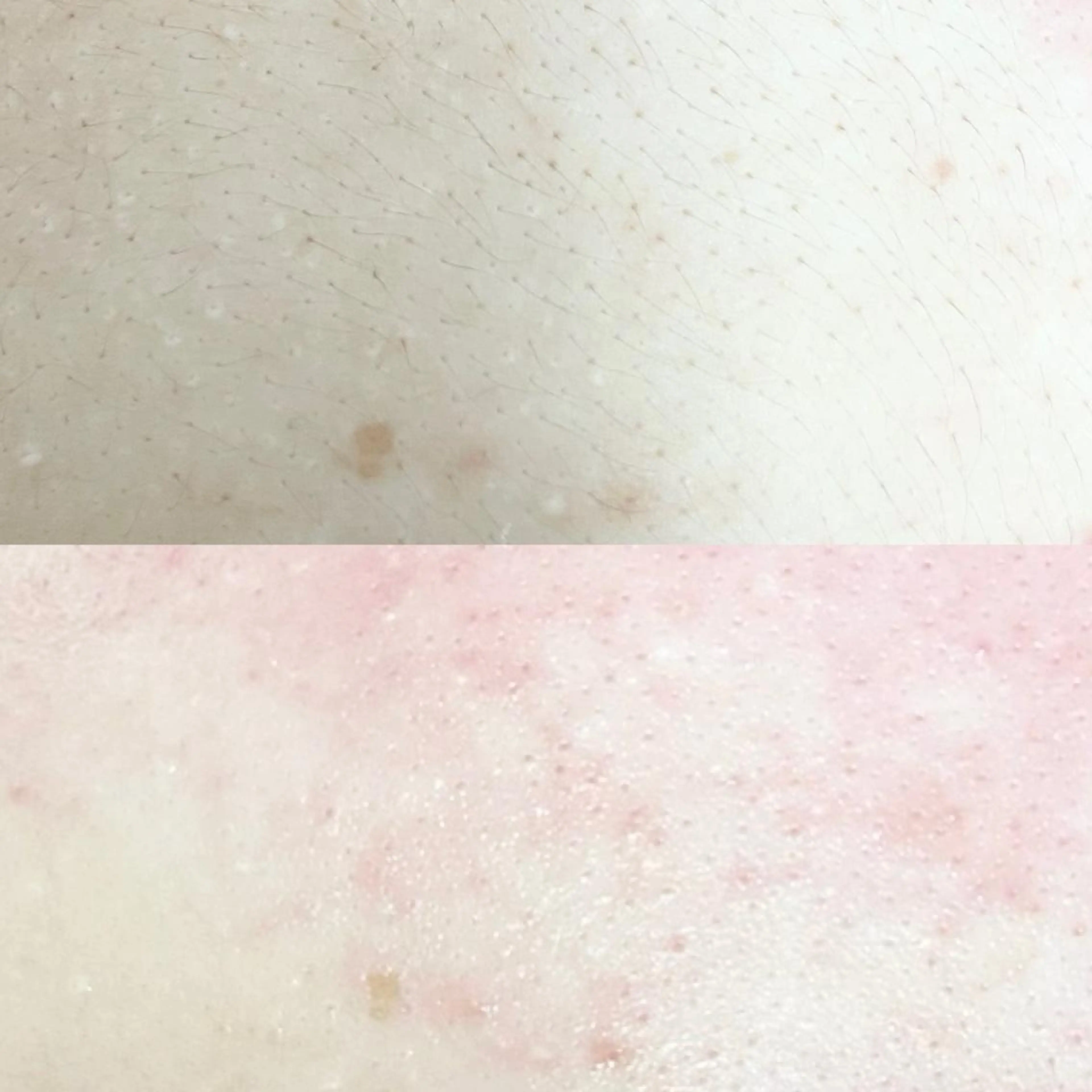 大人気🩶憧れの美背中になる背中wax✨の写真